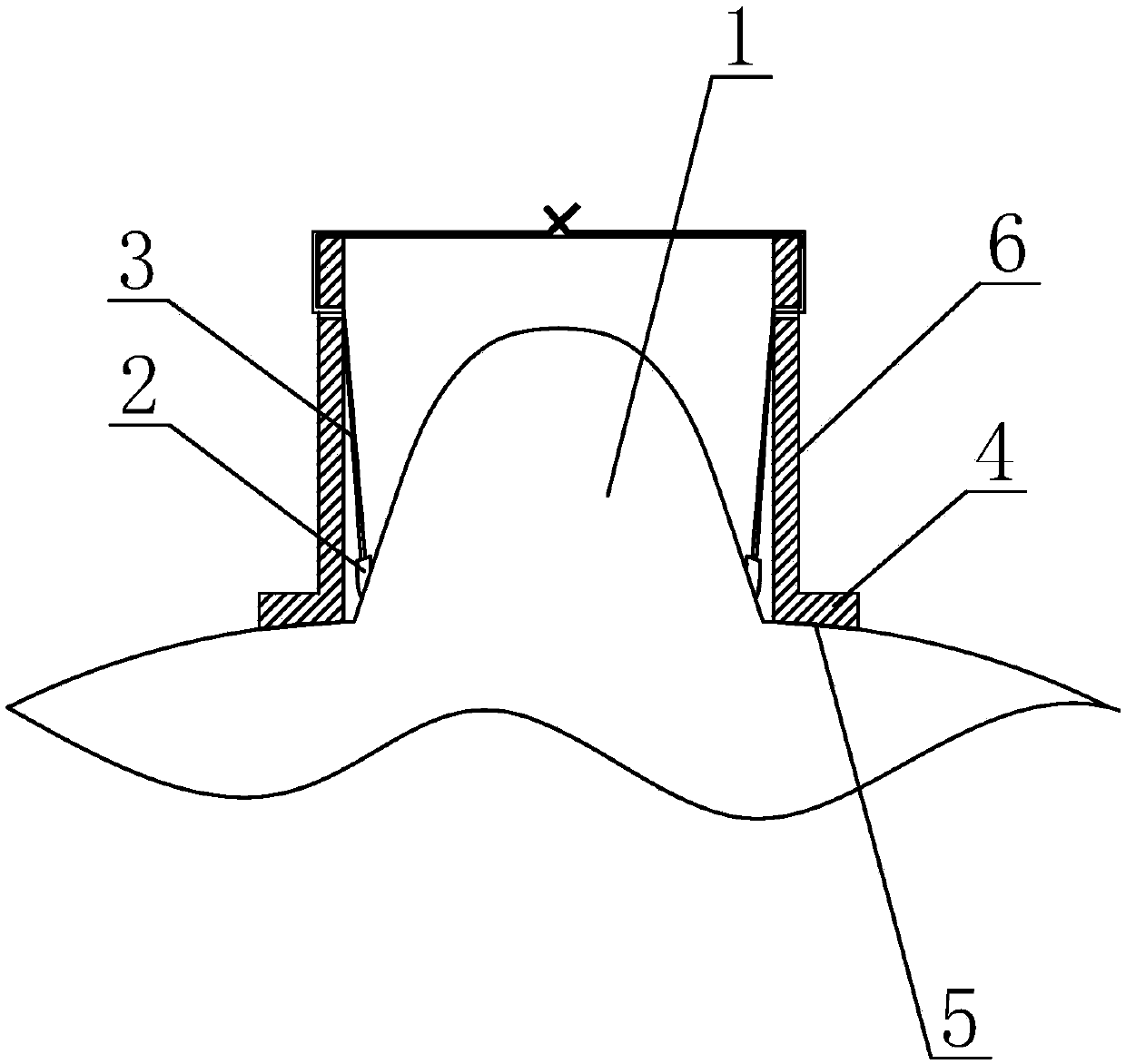 Method for performing nipple retraction correction through trocar
