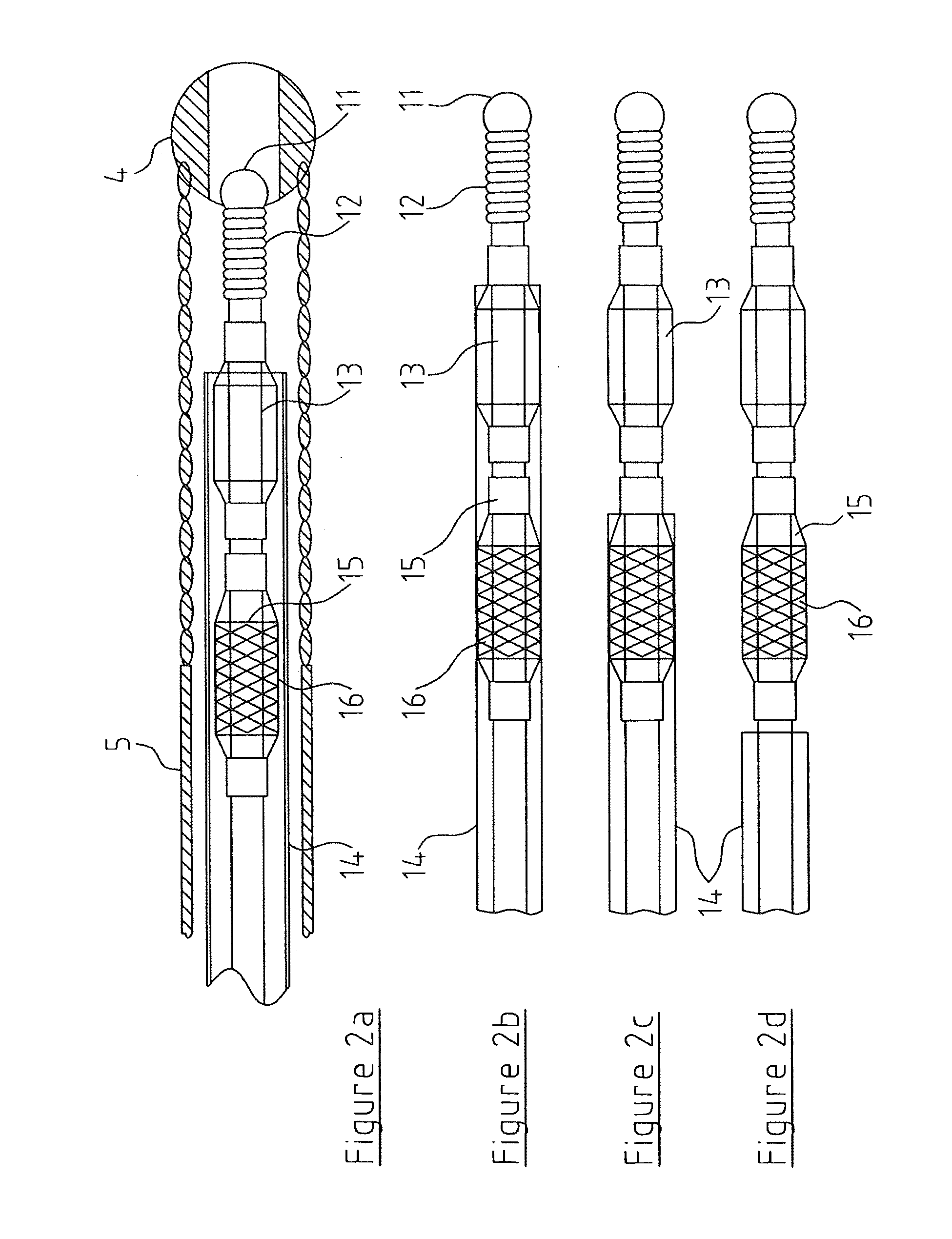 Angioplasty assembly