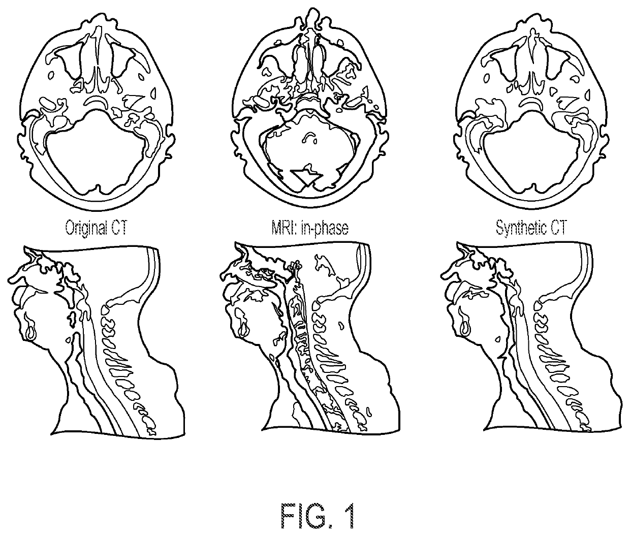 Methods and systems for synthetic computed tomography (CT) image creation