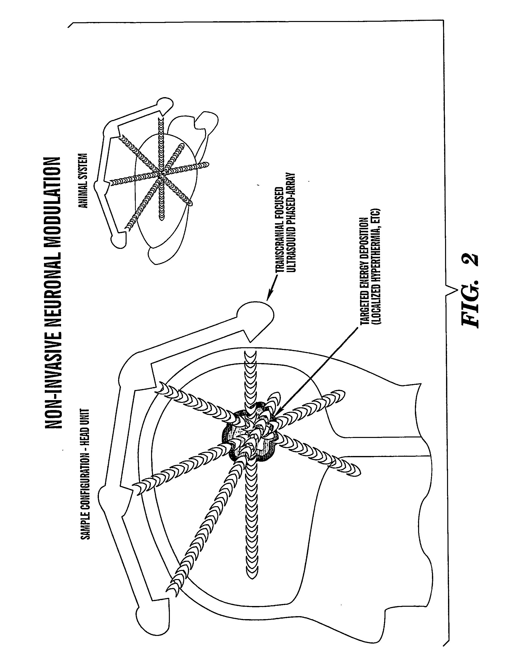 Localized non-invasive biological modulation system