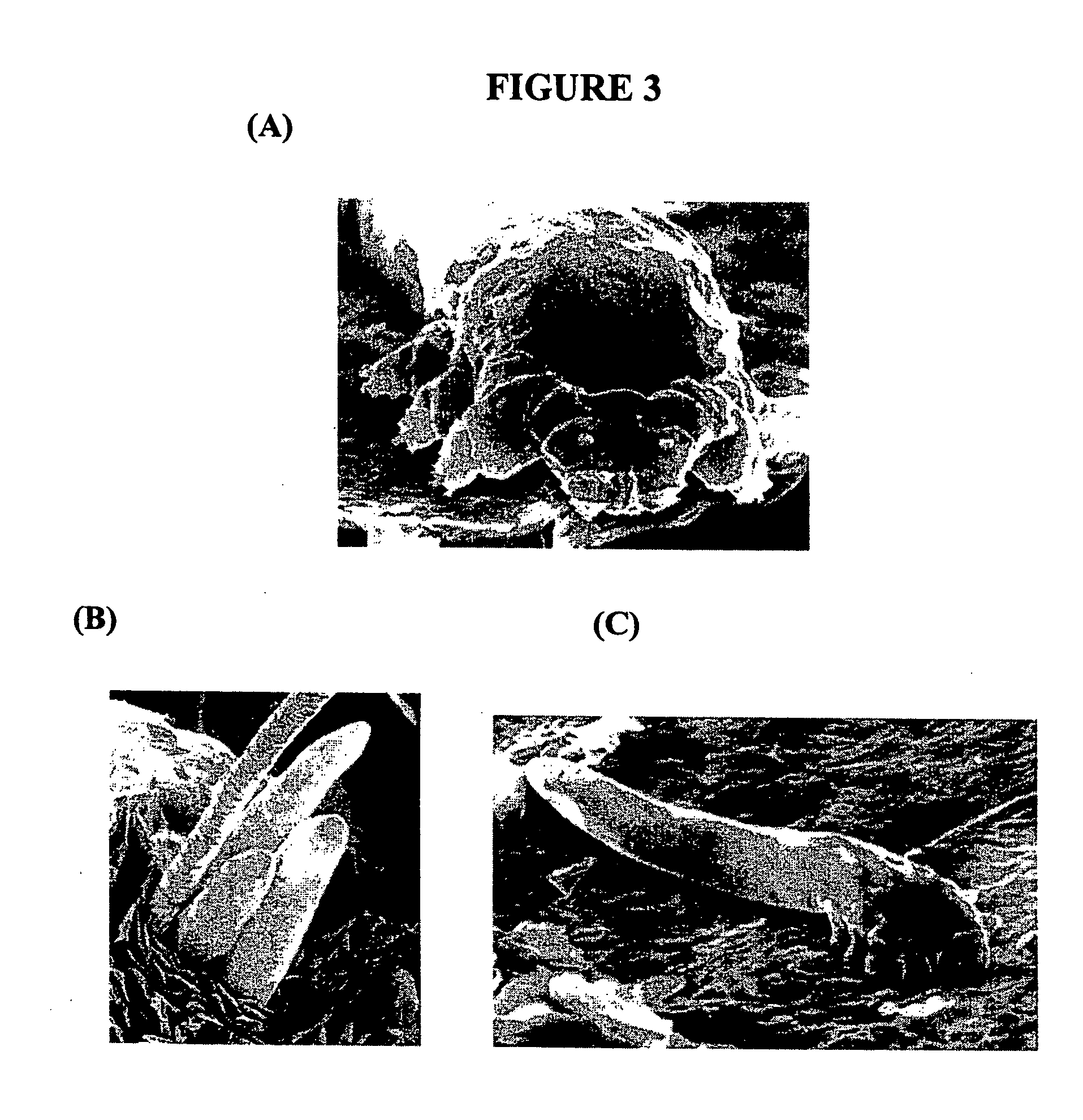 Compositions and methods for maintaining eyelid hygiene