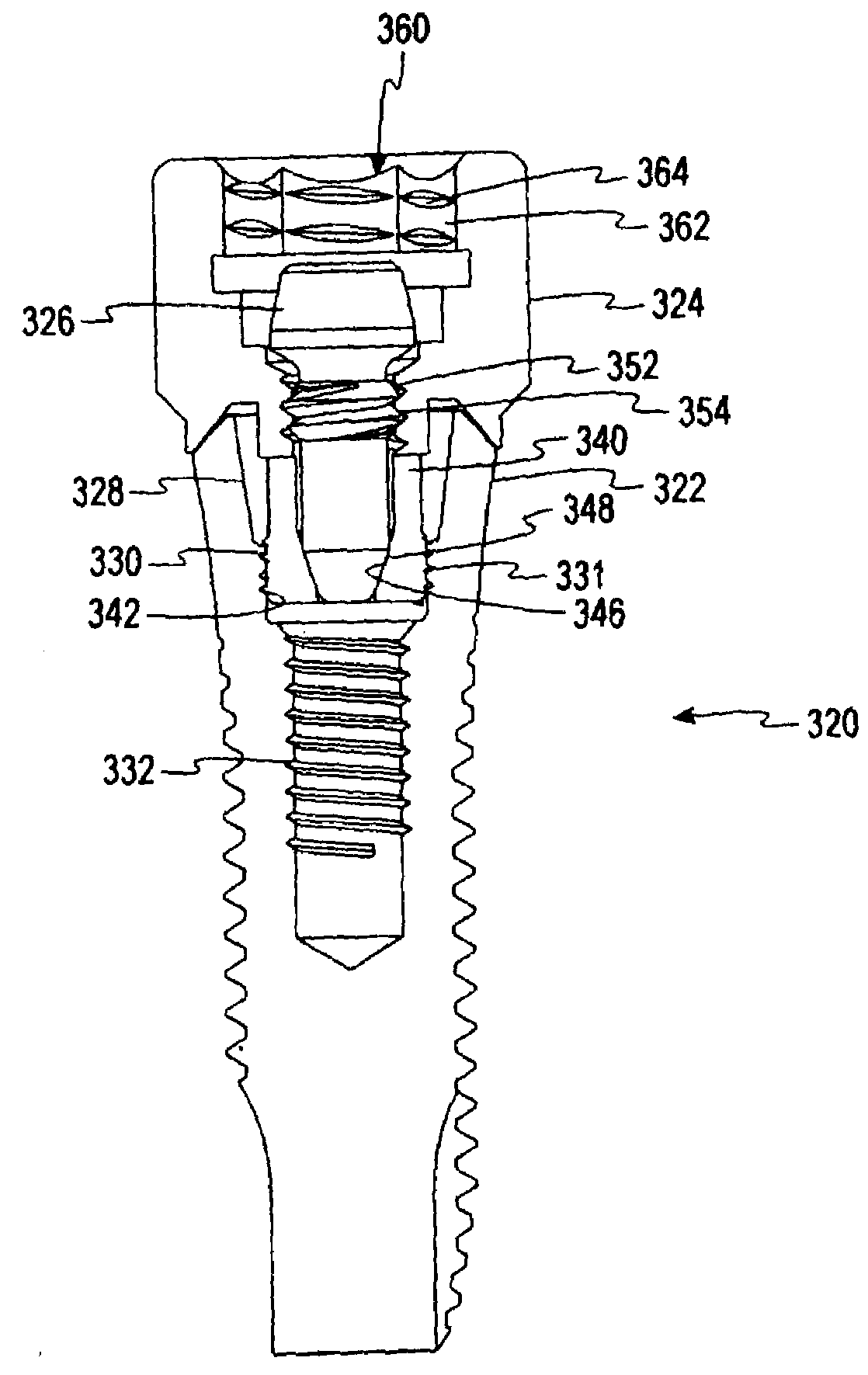 Implant delivery system