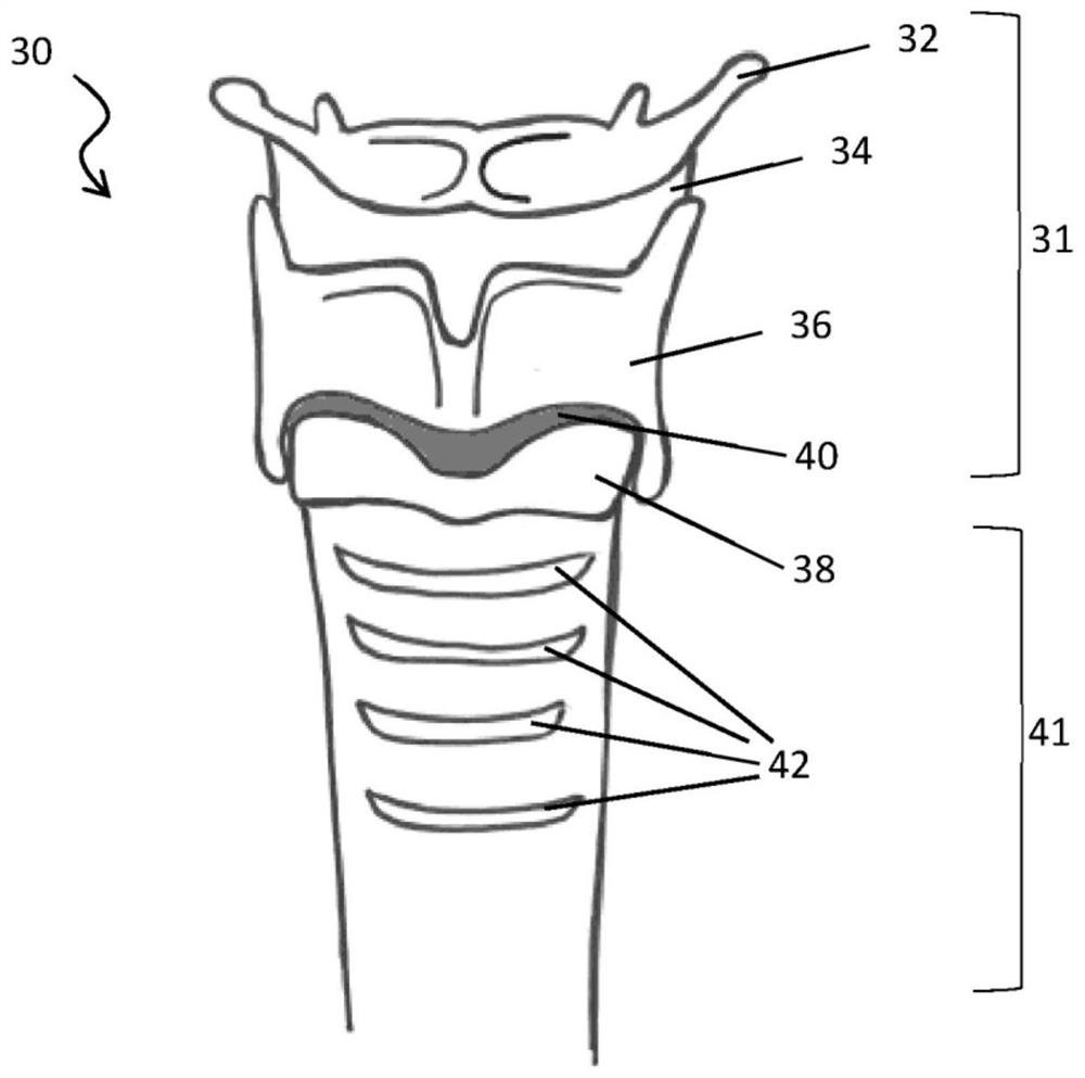 Airway operation simulation device for emergency surgical operation