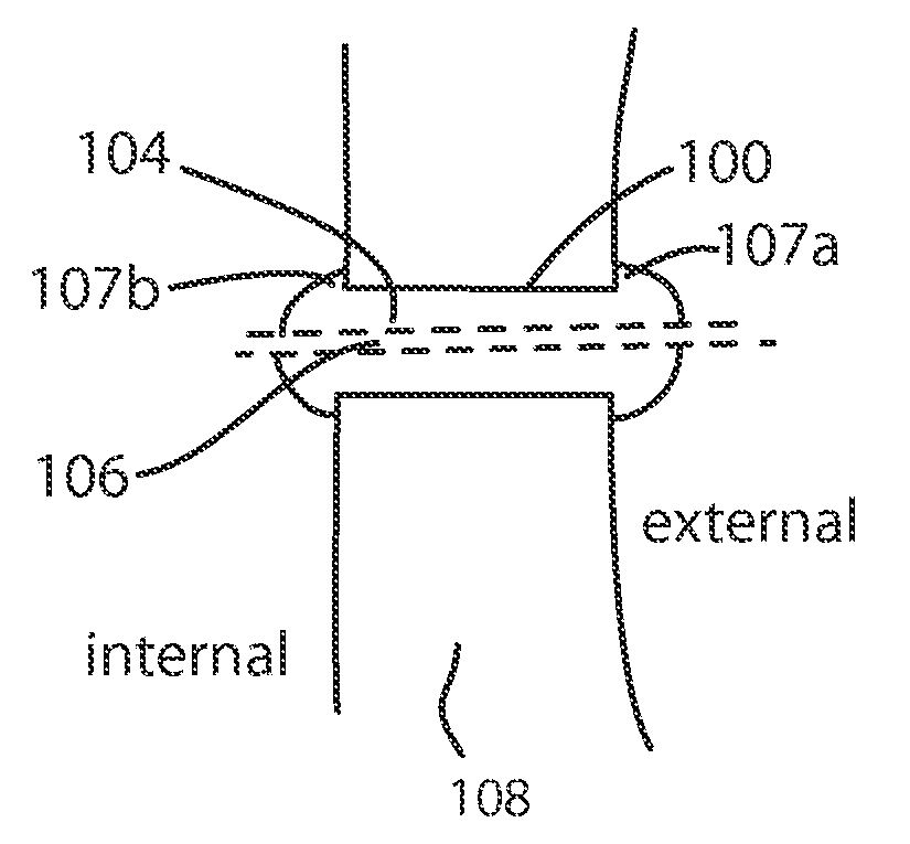 Glaucoma drainage device and uses thereof