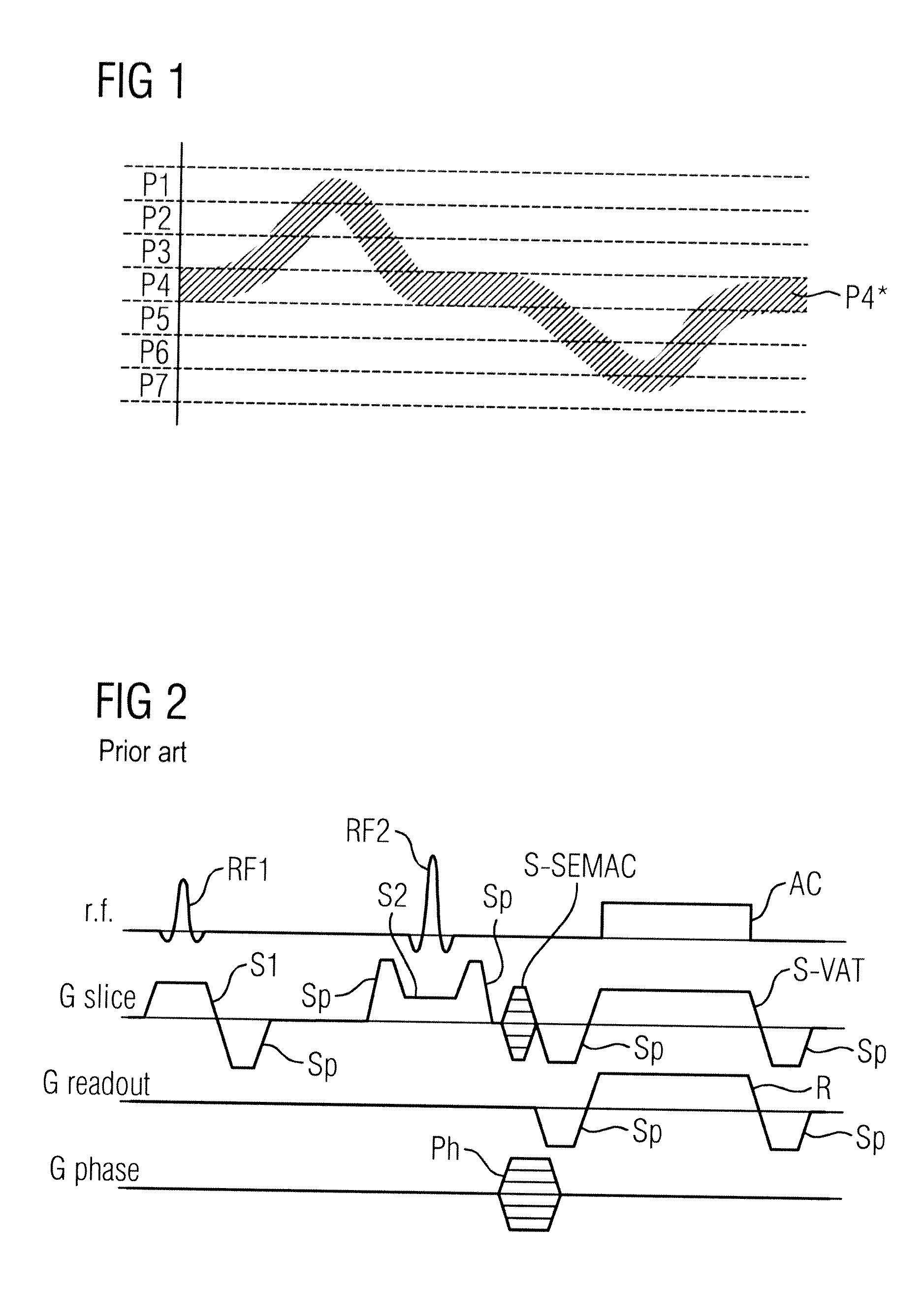 Magnetic resonance imaging method and apparatus to correct distortions due to inhomogeneities of the basic magnetic field