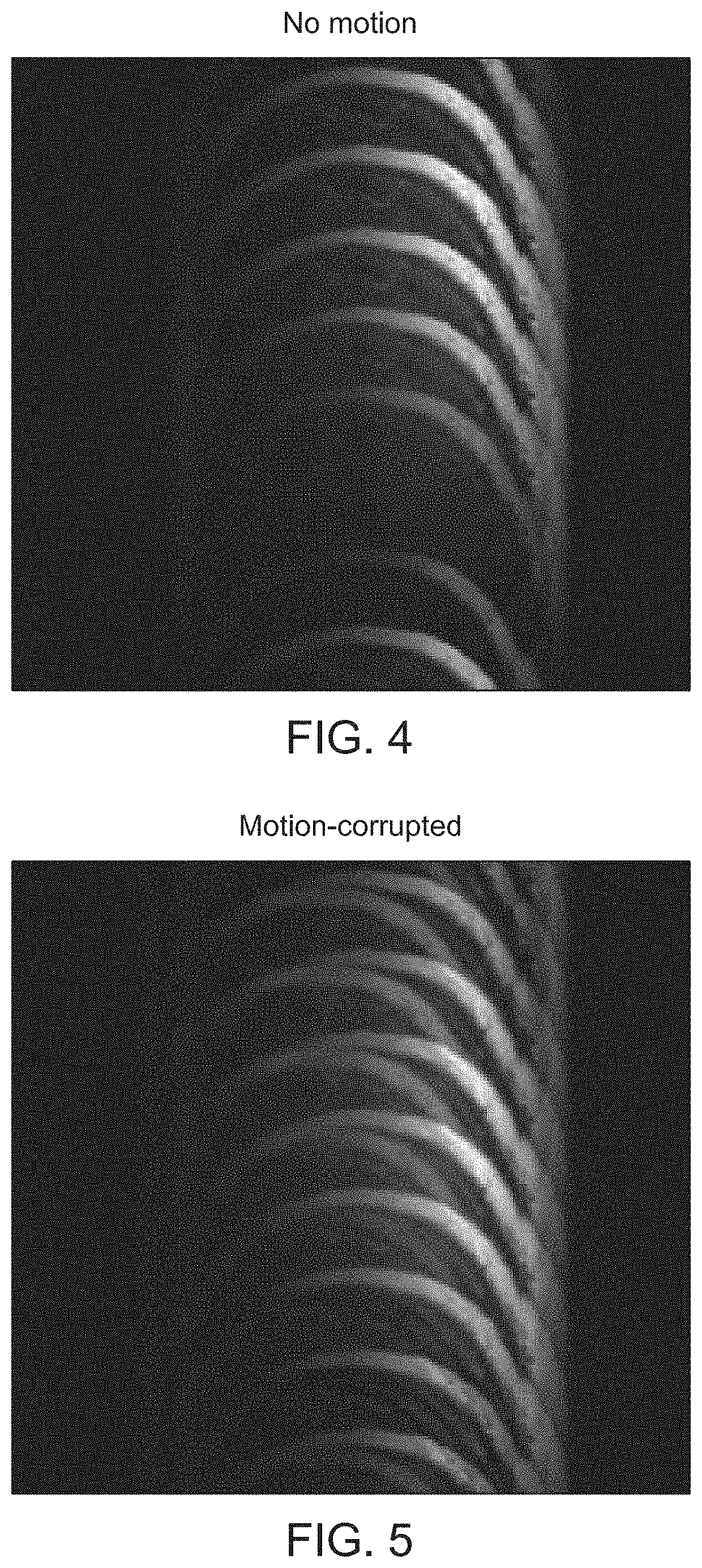 MRI system and method using neural network for detection of patient motion