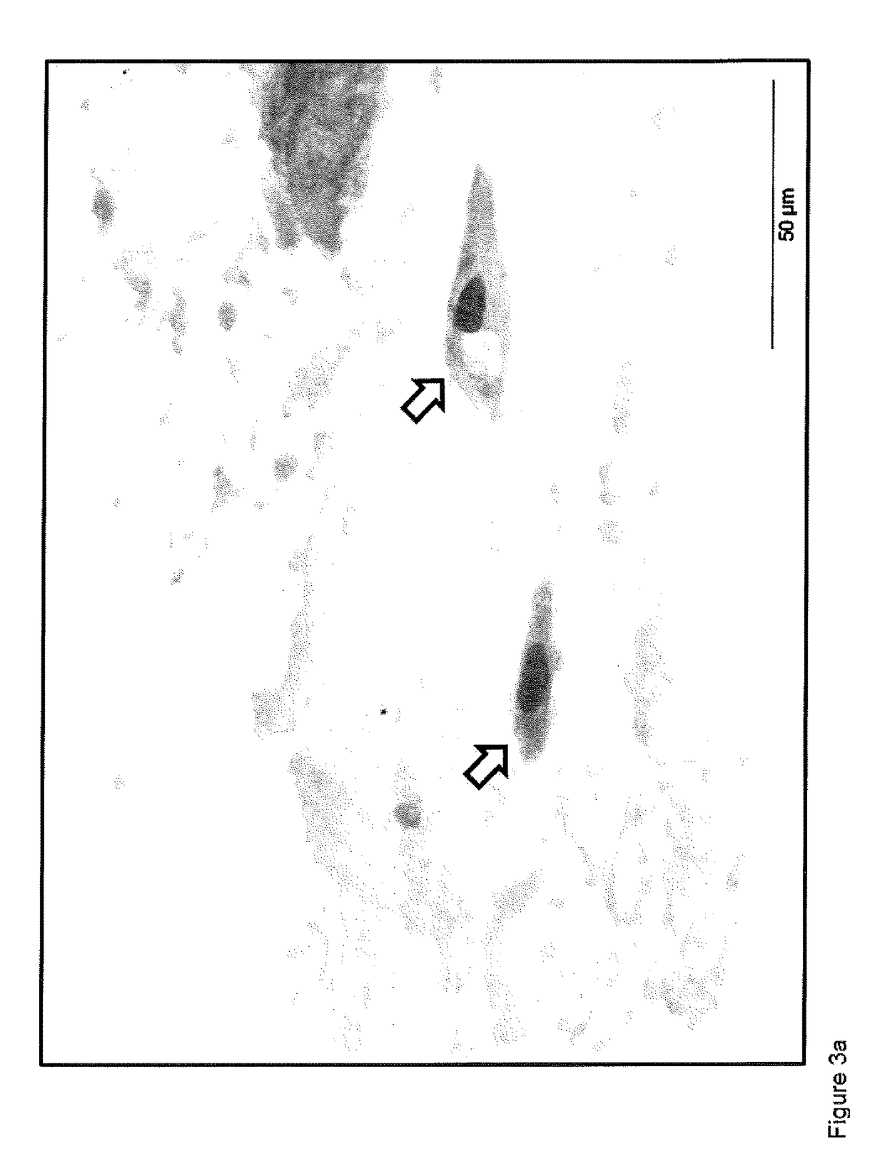 Method for diagnosing inflammatory bowel disease