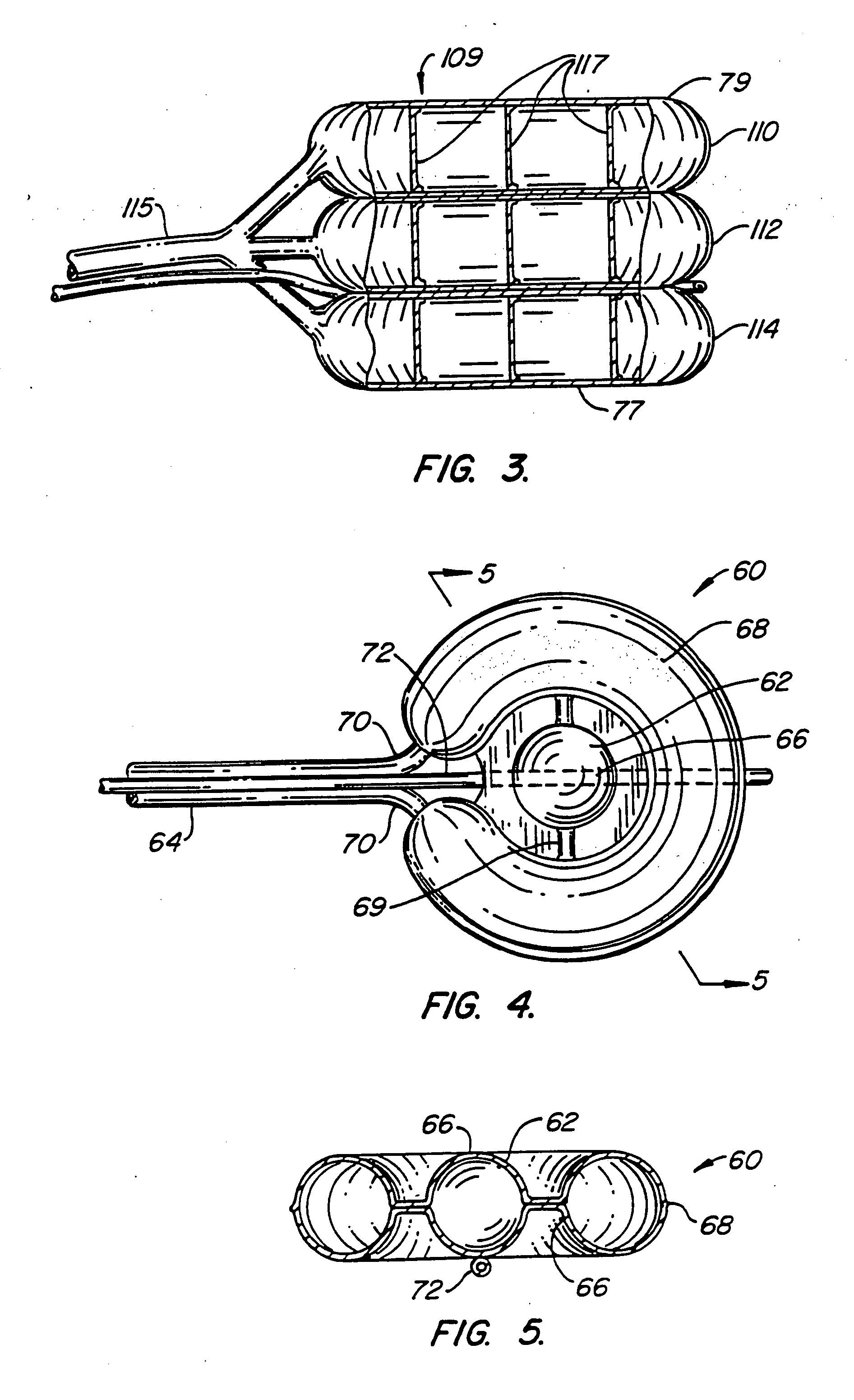 Inflatable device for use in surgical protocol relating to fixation of bone