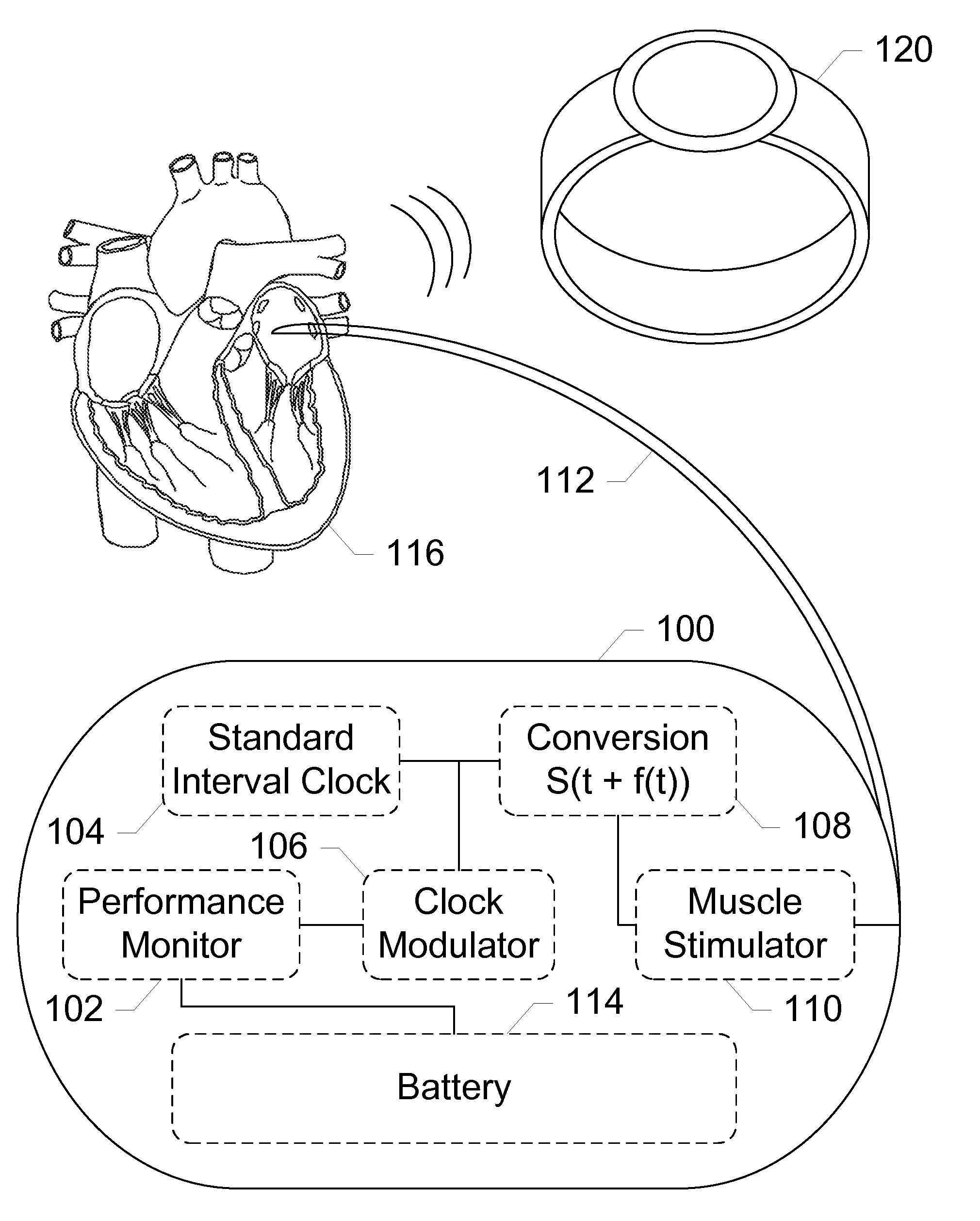 Mobile Applications and Methods for Conveying Performance Information of a Cardiac Pacemaker