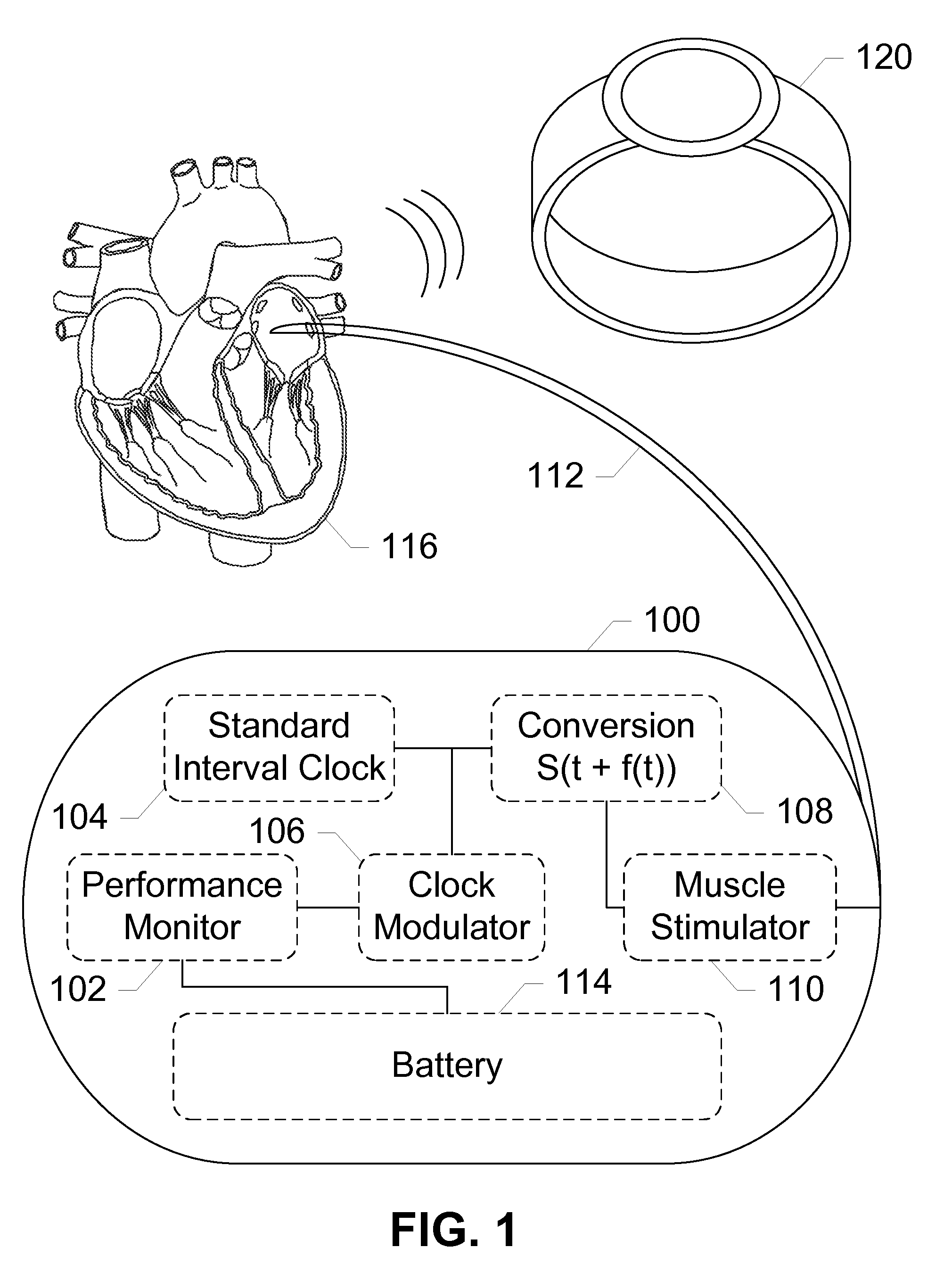 Mobile Applications and Methods for Conveying Performance Information of a Cardiac Pacemaker