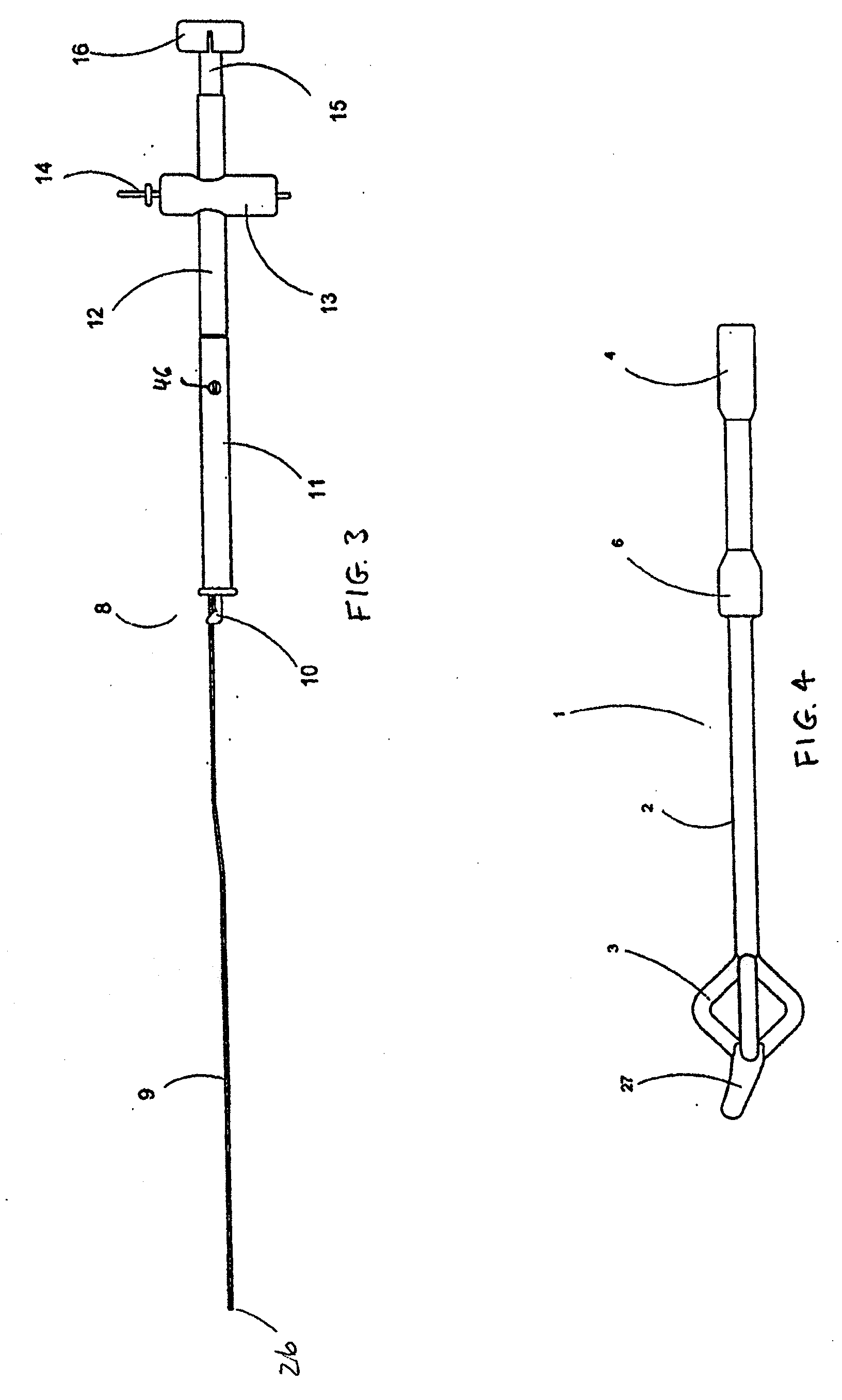 System and method for implanting a catheter