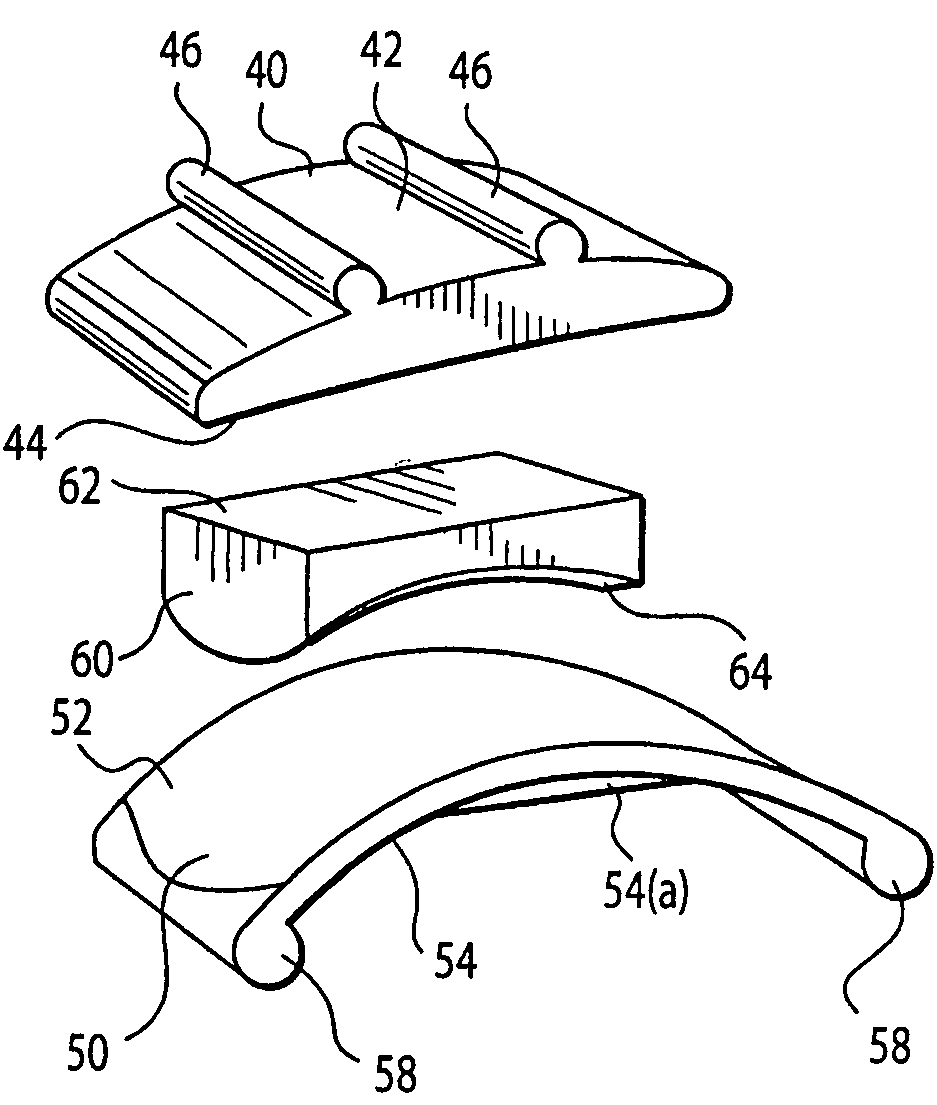 Ankle joint prosthesis and its method of implantation