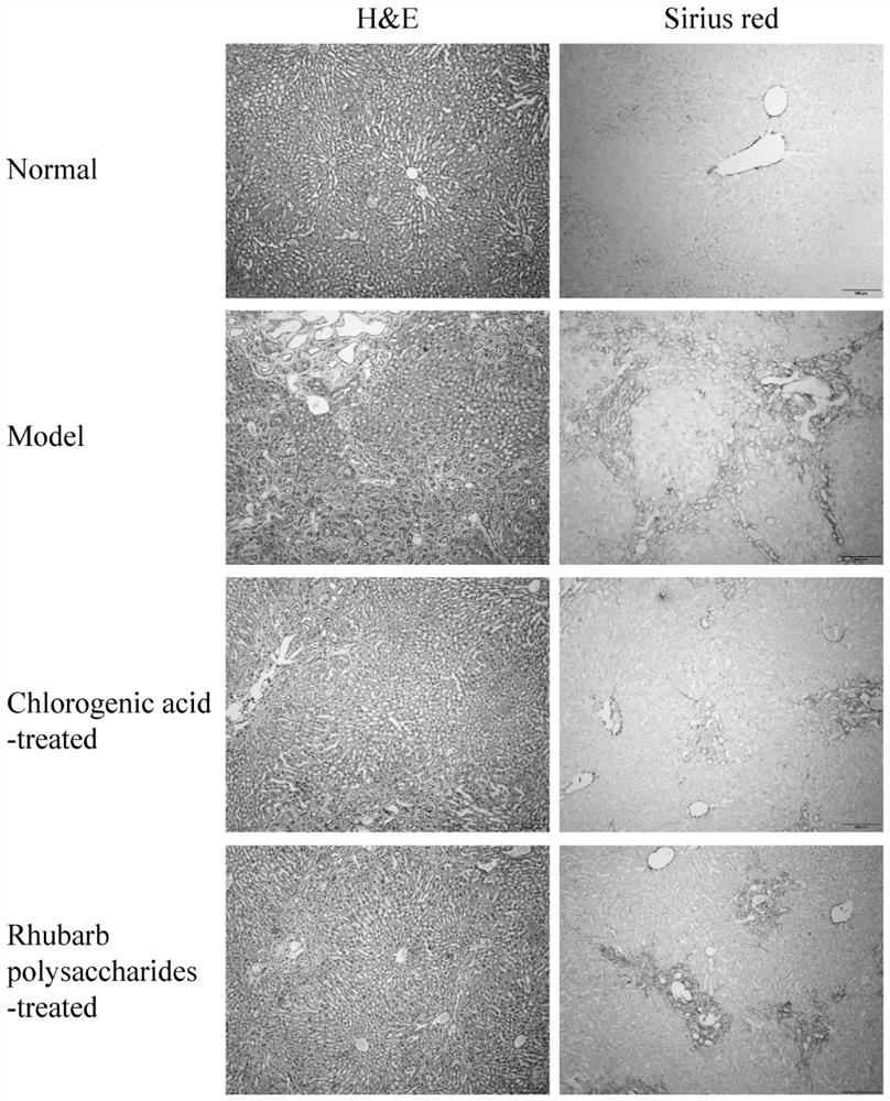 A traditional Chinese medicine component composition for treating and/or preventing liver and gallbladder diseases and its application