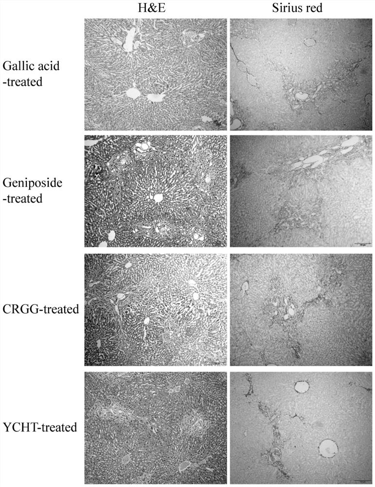 A traditional Chinese medicine component composition for treating and/or preventing liver and gallbladder diseases and its application