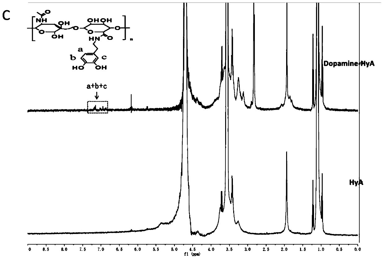 Dopamine-hyaluronic acid coating material, preparation method and its application in promoting specific adhesion of dental pulp stem cells to dentin