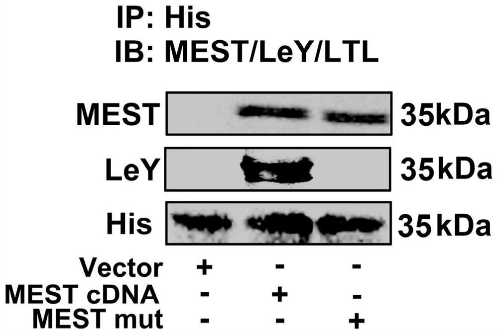 Biomarker for auxiliary diagnosis of recurrent abortion and application thereof