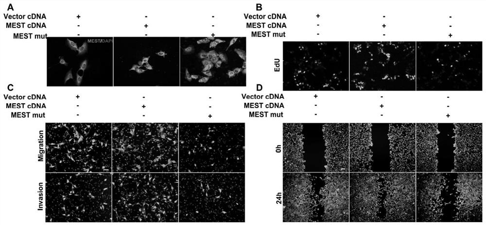 Biomarker for auxiliary diagnosis of recurrent abortion and application thereof