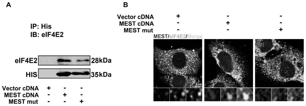 Biomarker for auxiliary diagnosis of recurrent abortion and application thereof