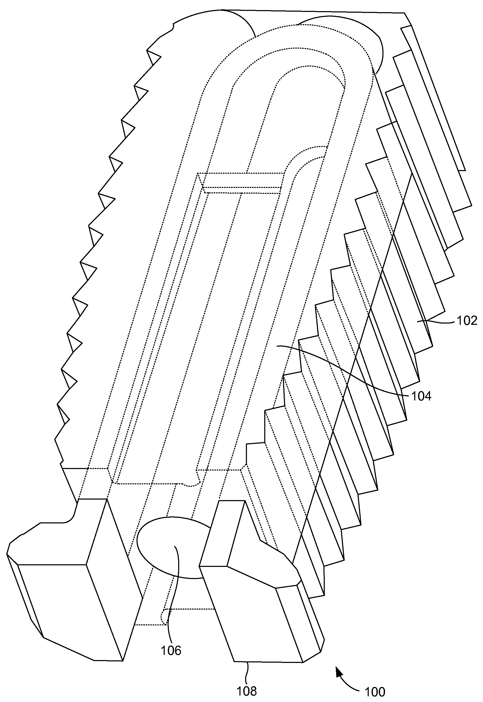 Compliant Interbody Fusion Device With Deployable Bone Anchors