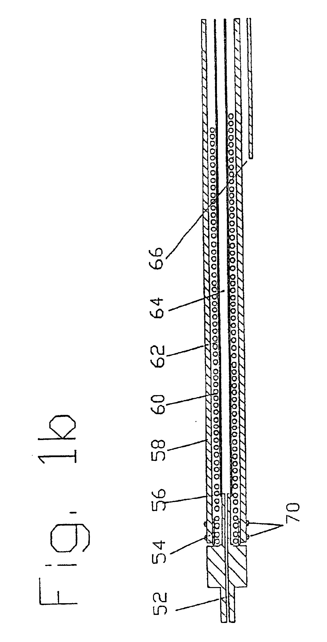 Cardiac drug delivery system