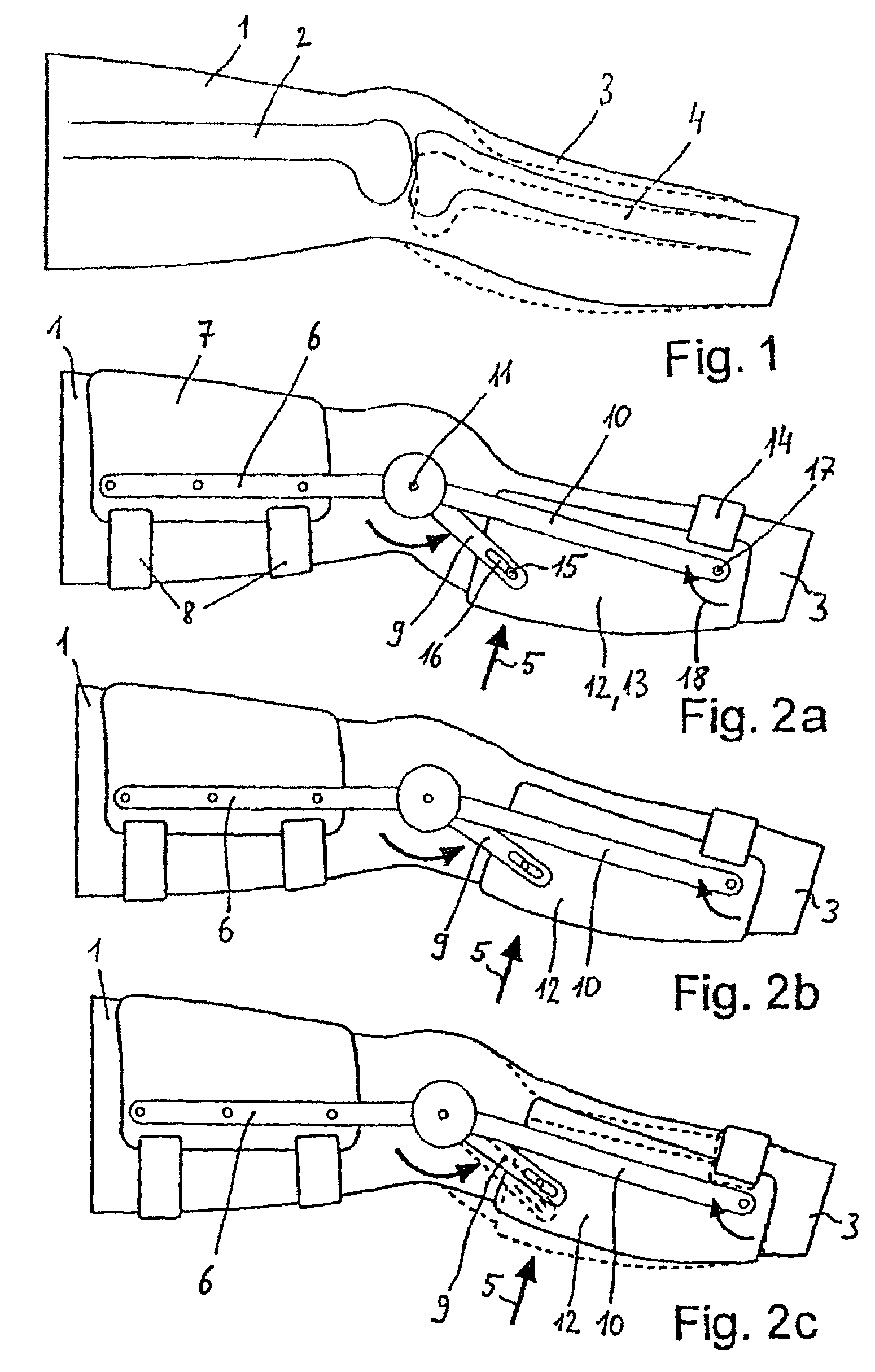 Device for applying a ventrally or dorsally directed translatory force in the area of a knee joint