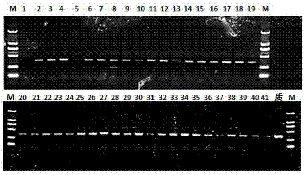 Method for obtaining desmodesmus NMX451 and genetic transformation method of desmodesmus NMX451