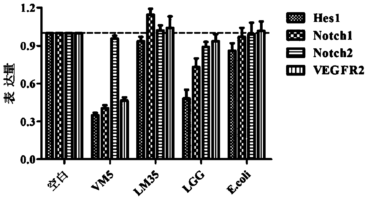 A kind of Lactococcus lactis lactic acid subspecies capable of regulating colon tumor signaling pathway and its use