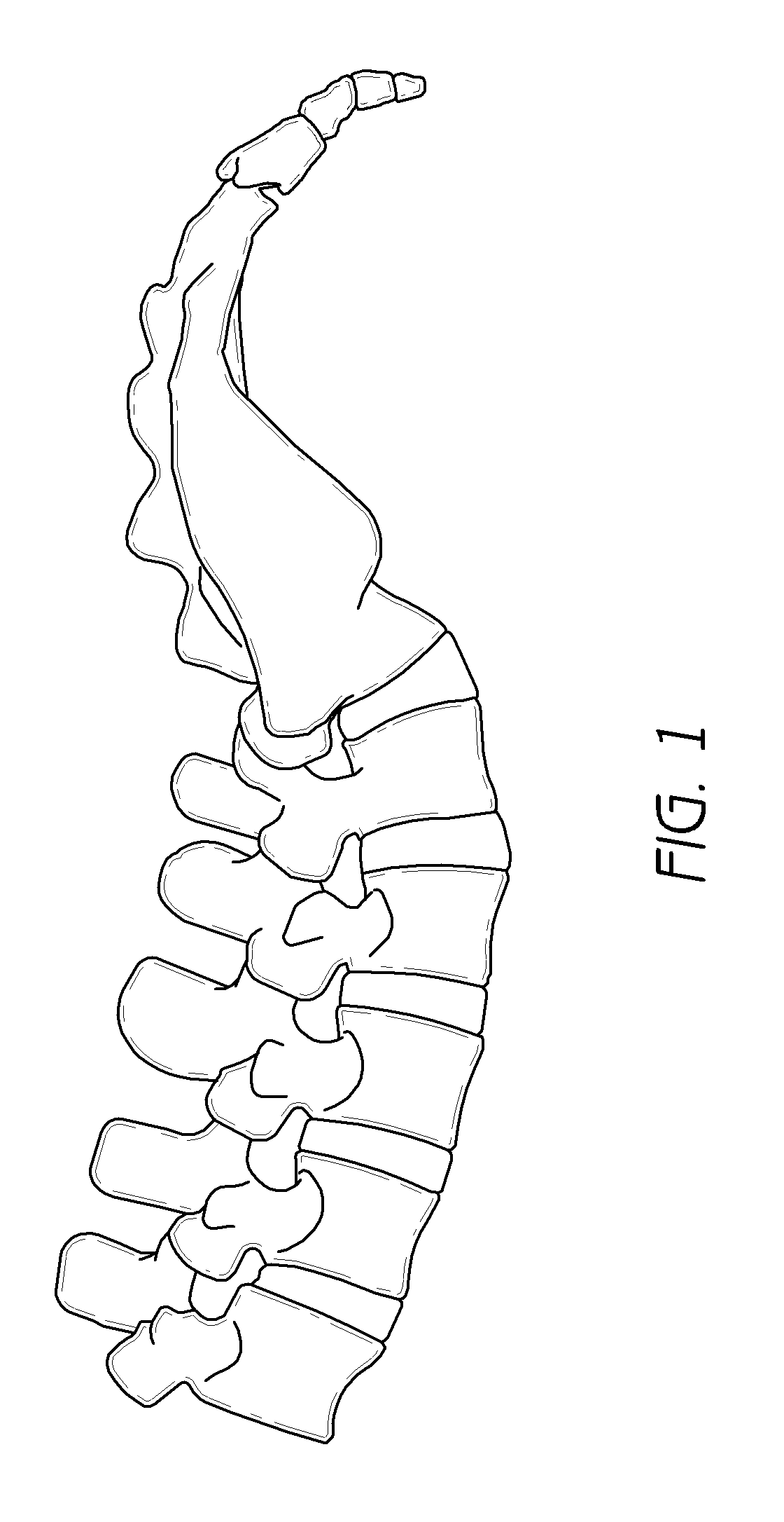 Spinous process spacer and implantation procedure