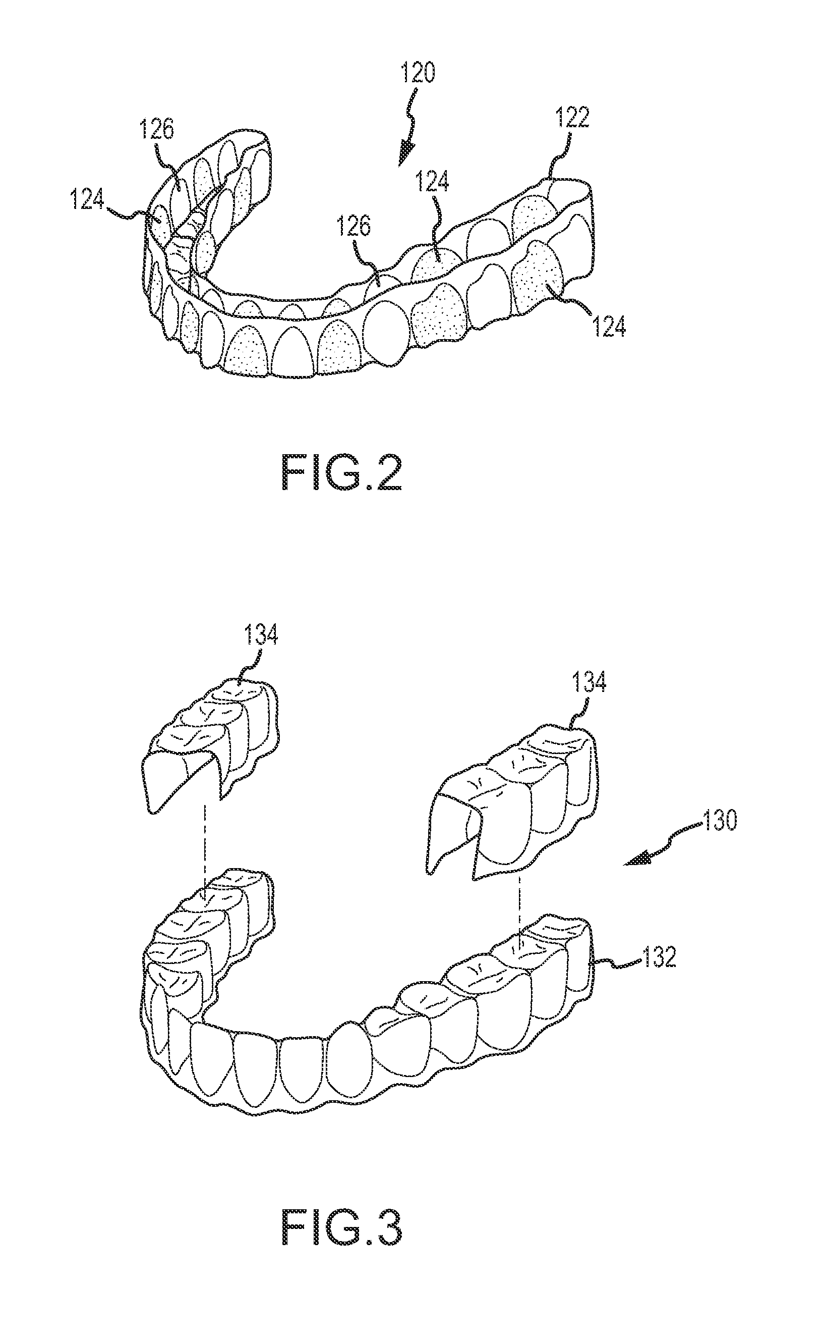 Dental appliance, dental appliance adhesive and related methods and uses