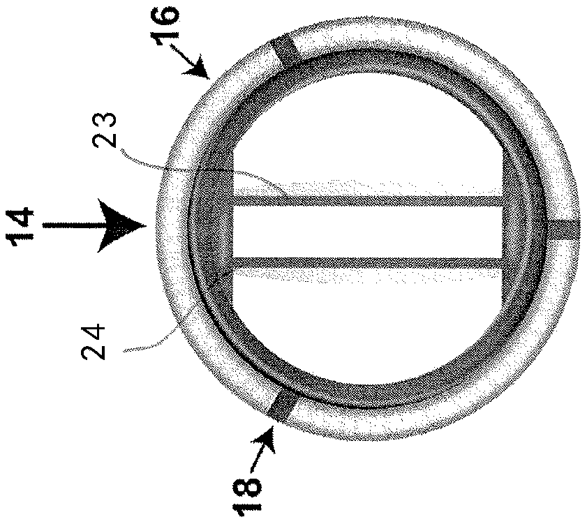 Methods for inhibiting stenosis, obstruction, or calcification of stented heart valve or bioprosthesis