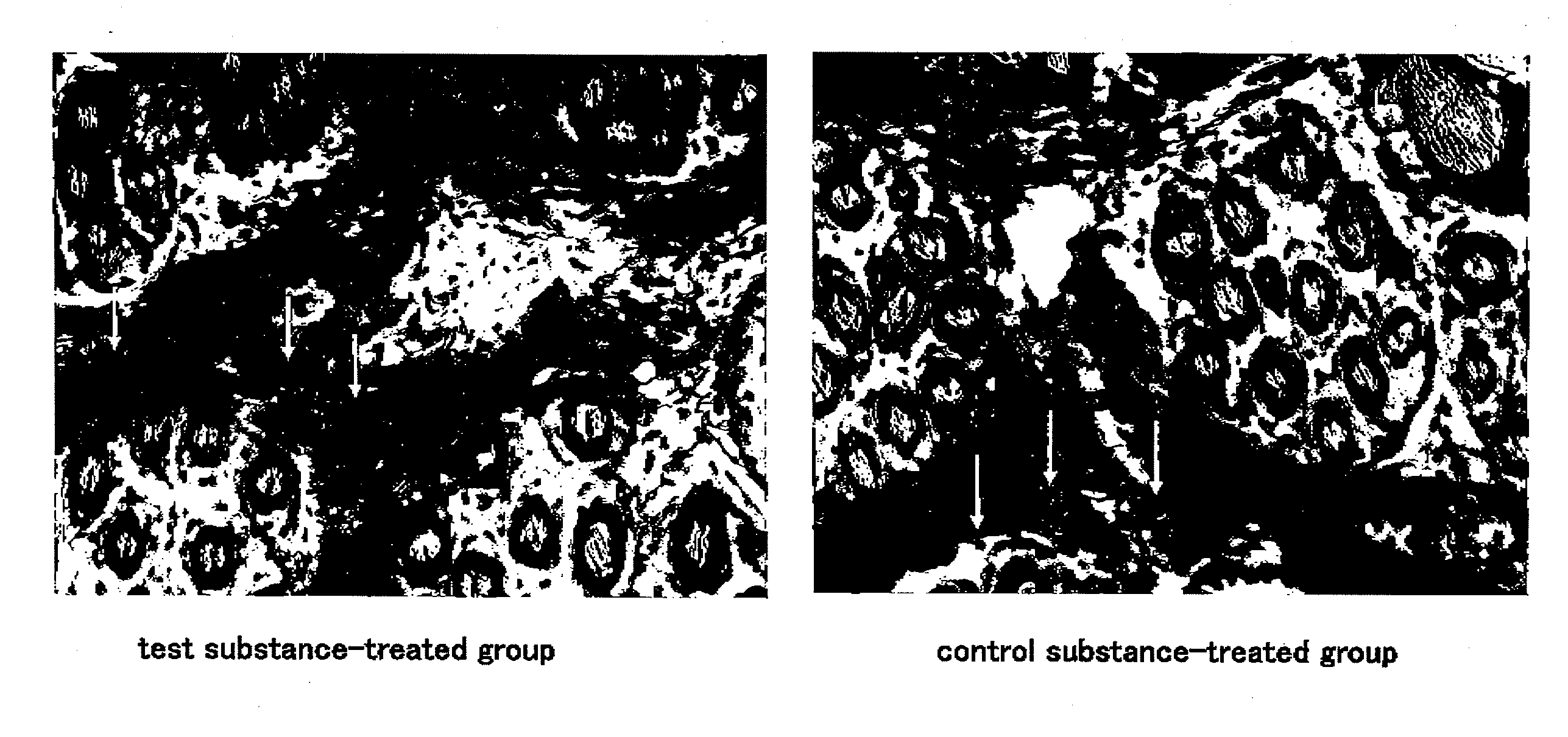 Method of regenerating  elastic fiber and screening method