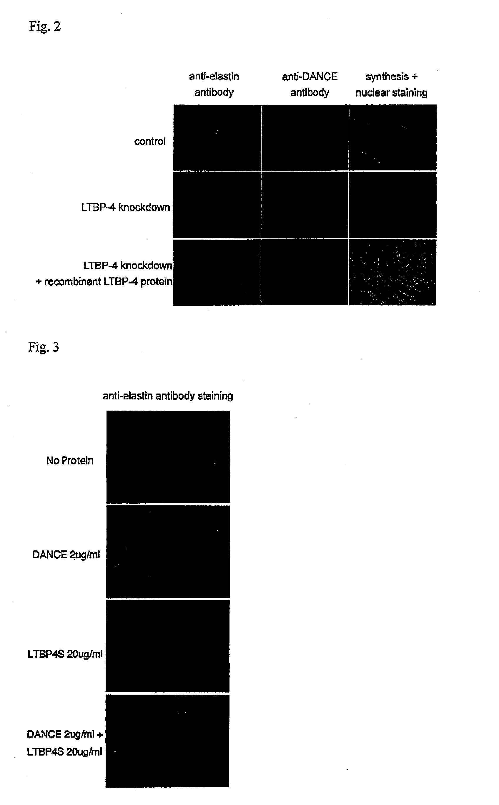 Method of regenerating  elastic fiber and screening method