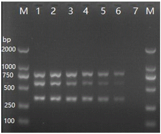 Detection primer set of Streptococcus agalactiae, detection kit and multiplex PCR detection method