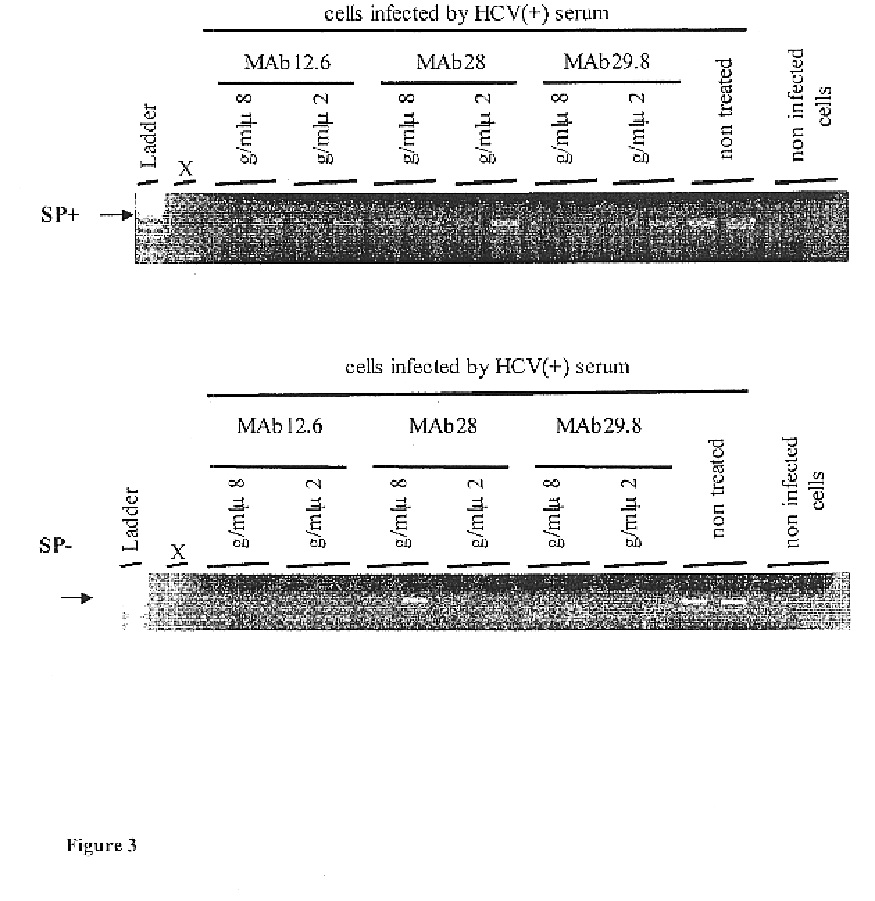 Monoclonal antibodies to the human LDL receptor, their production and use
