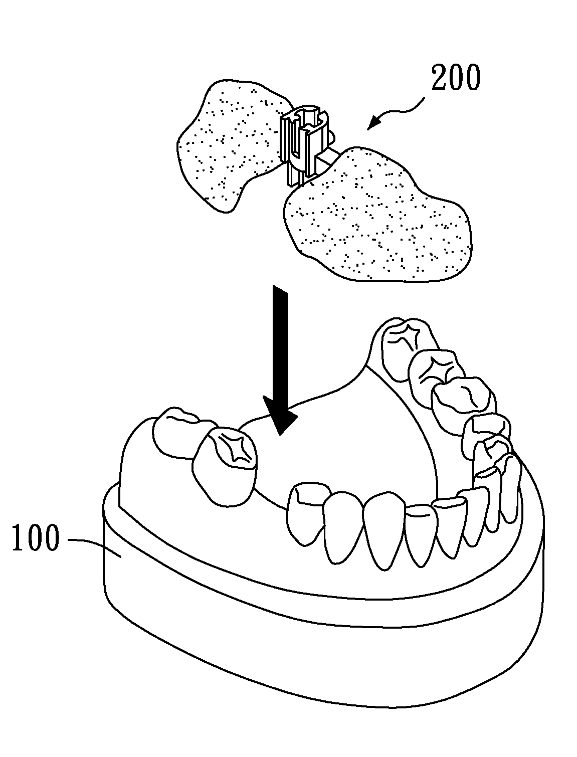 Planning and guiding method and excavation guiding device for correctly implanting artificial tooth root at predetermined site