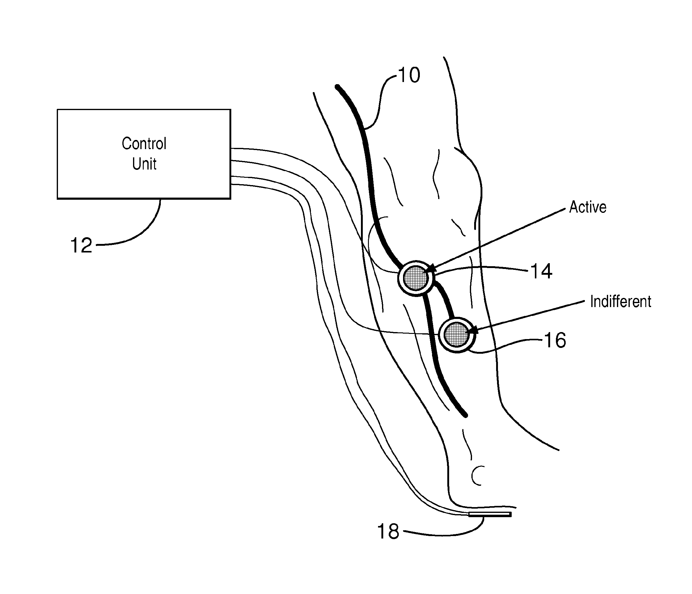 Apparatus for functional electrical stimulation of the body