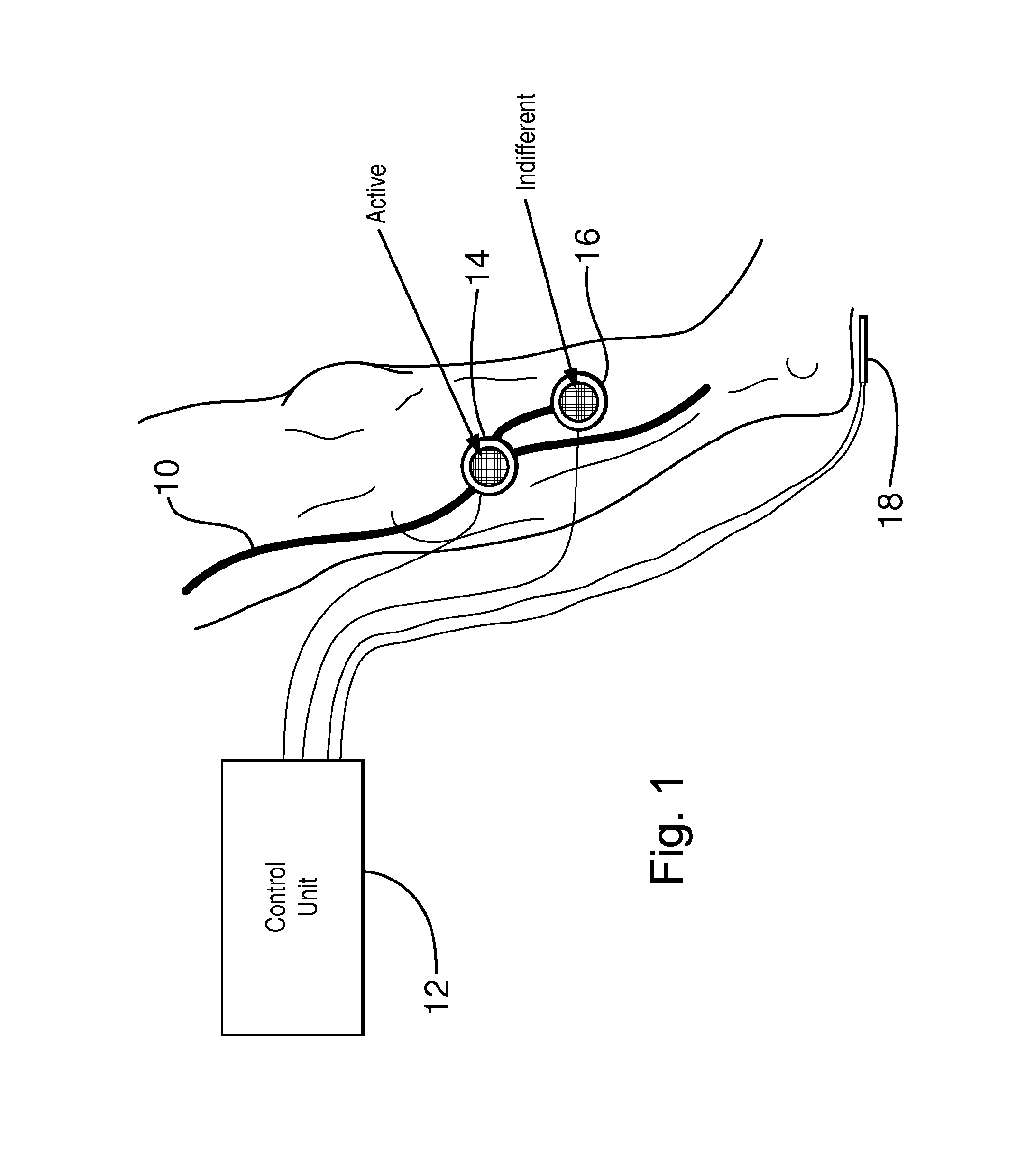 Apparatus for functional electrical stimulation of the body