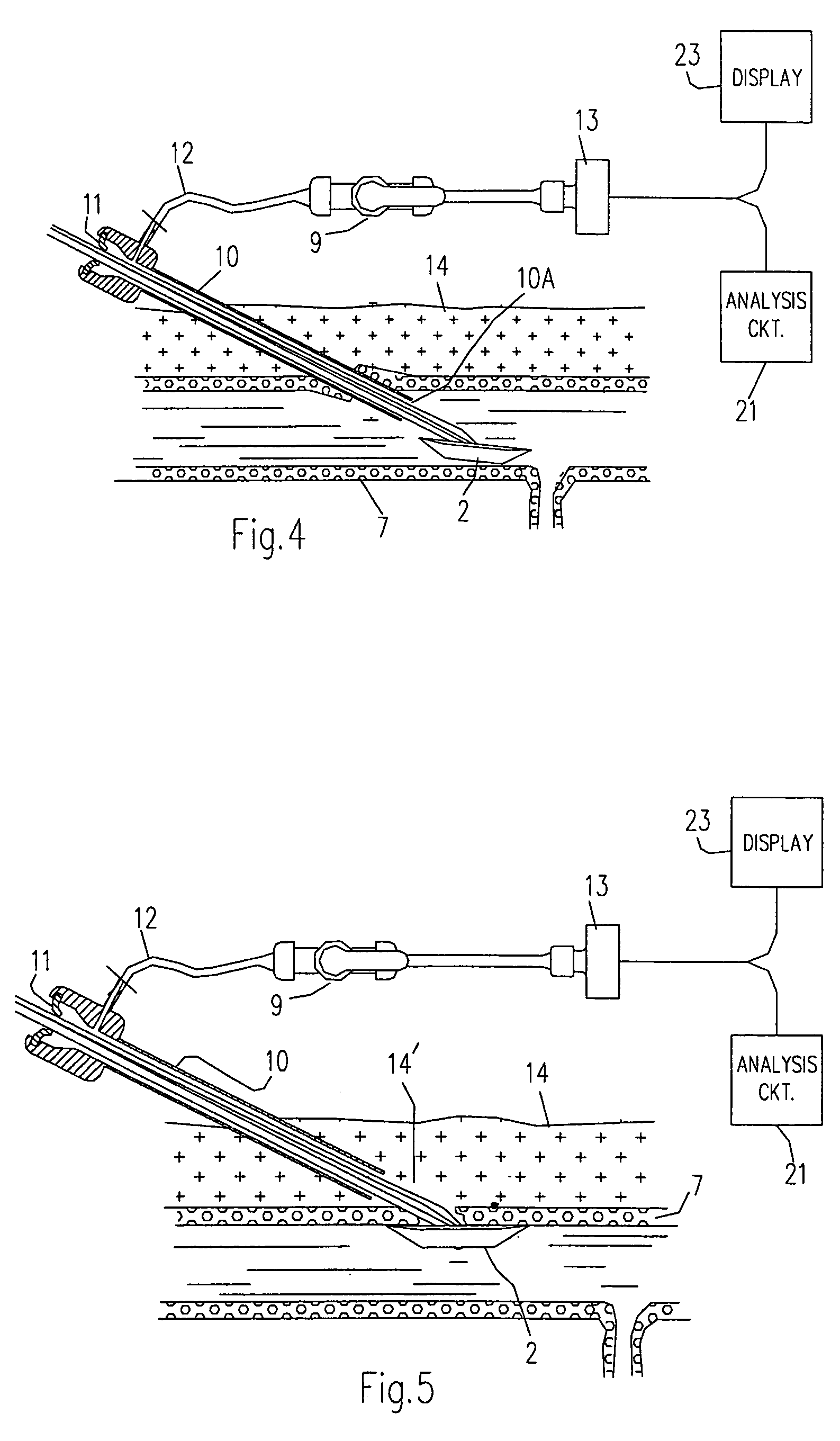 Technique to confirm correct positioning of arterial wall sealing device