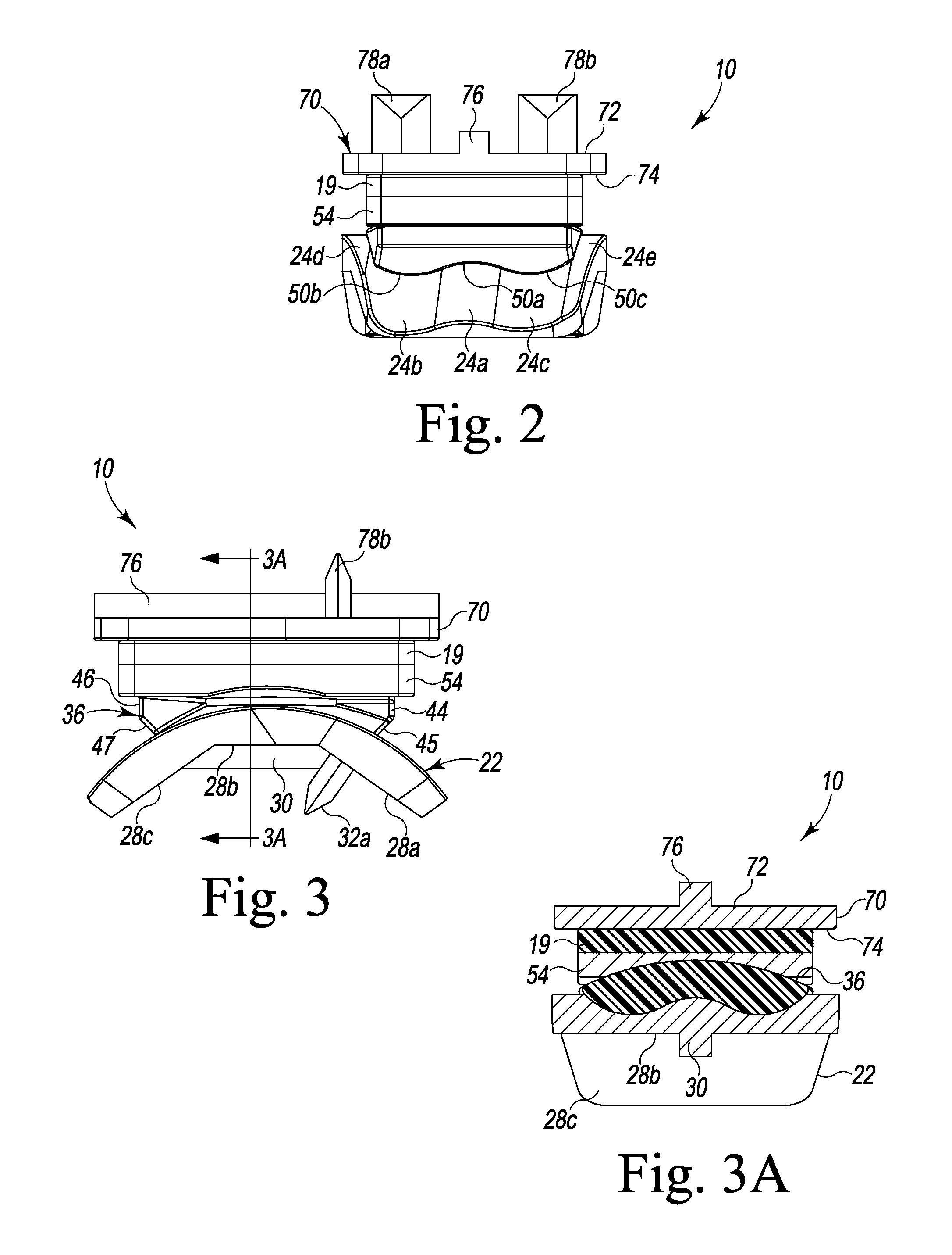 Prosthetic Device with Multi-Axis Dual Bearing Assembly and Methods for Resection