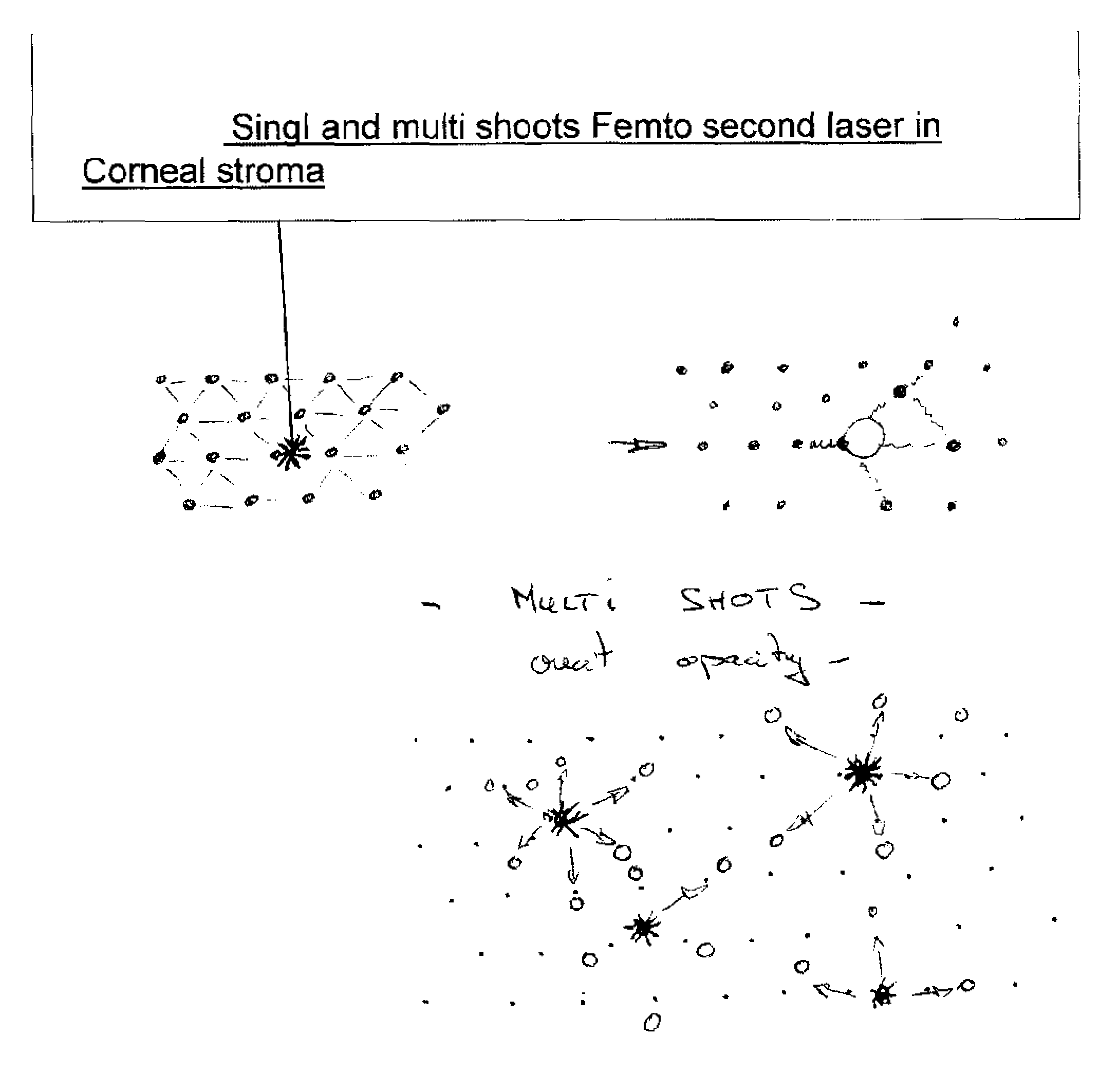 Femto second multi shooting for eye surgery