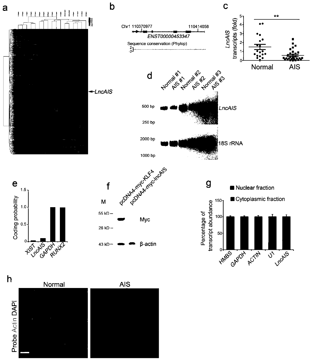 Biological agents promoting osteogenic differentiation of bone marrow mesenchymal stem cells