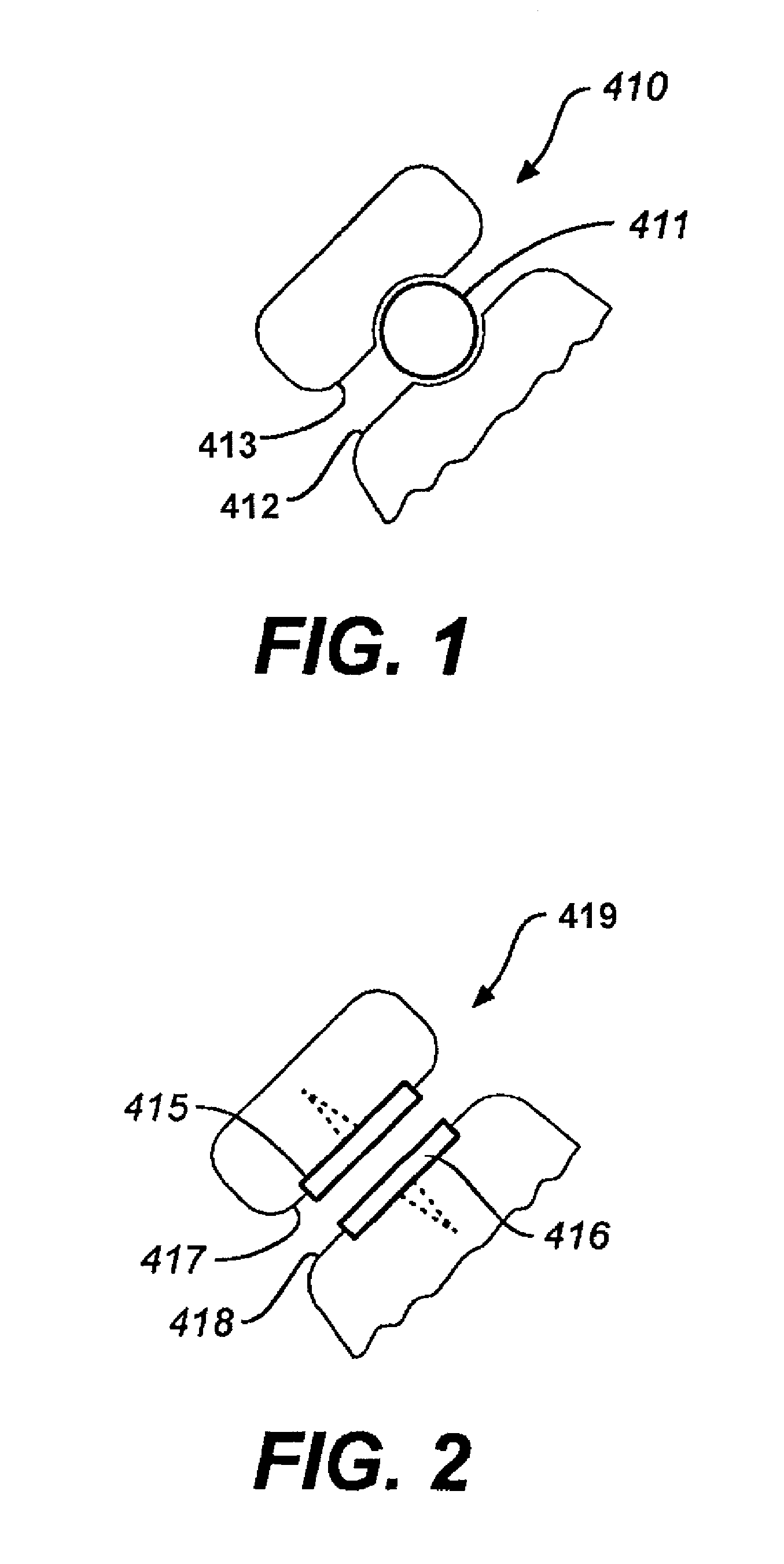 Facet device and method