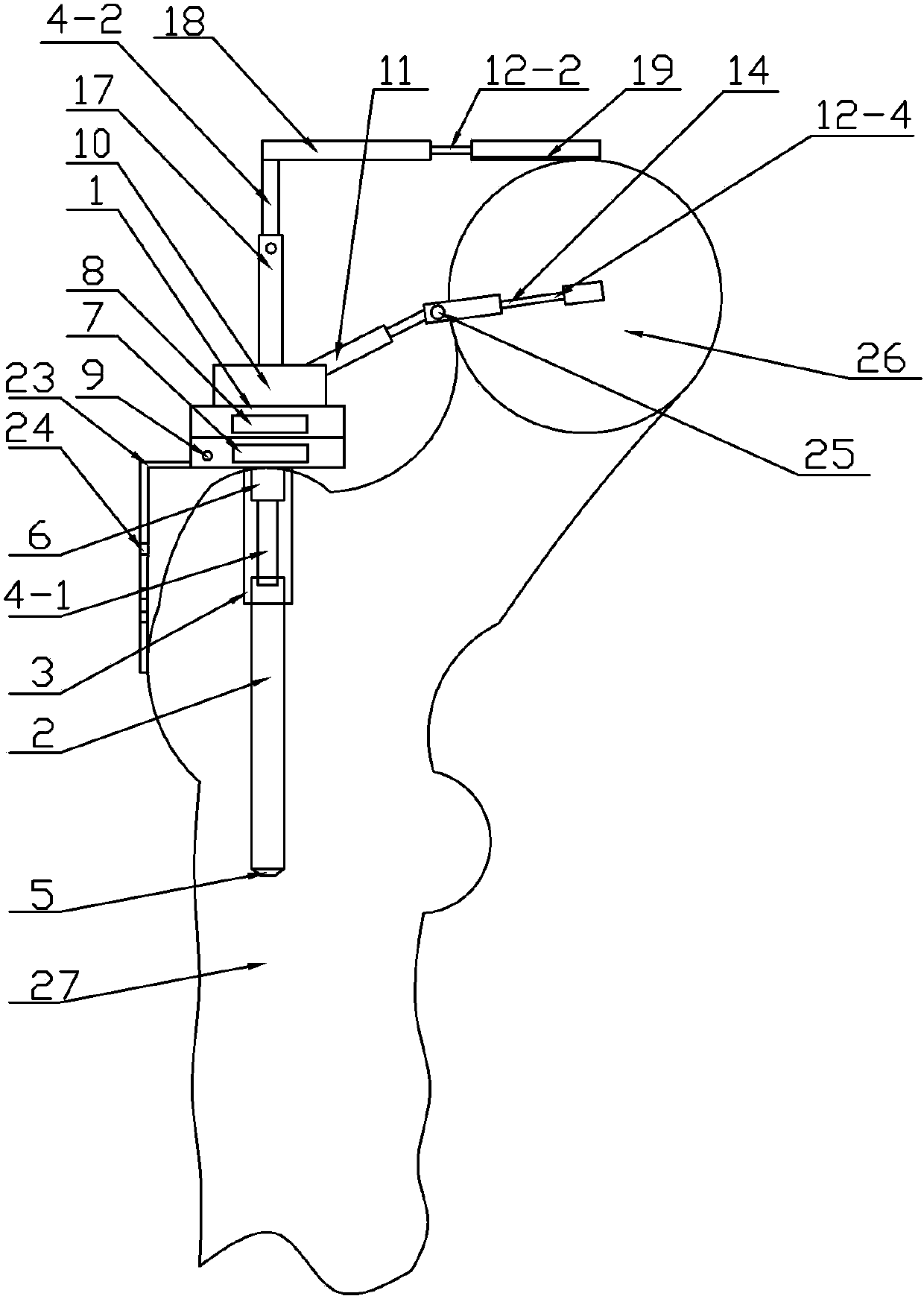 Measurer for measuring femoral offset in orthopedic operation