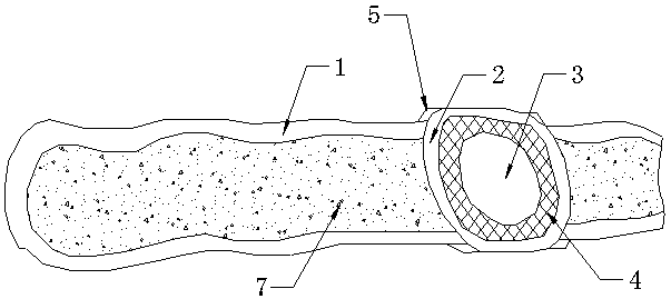 Novel hernia belt