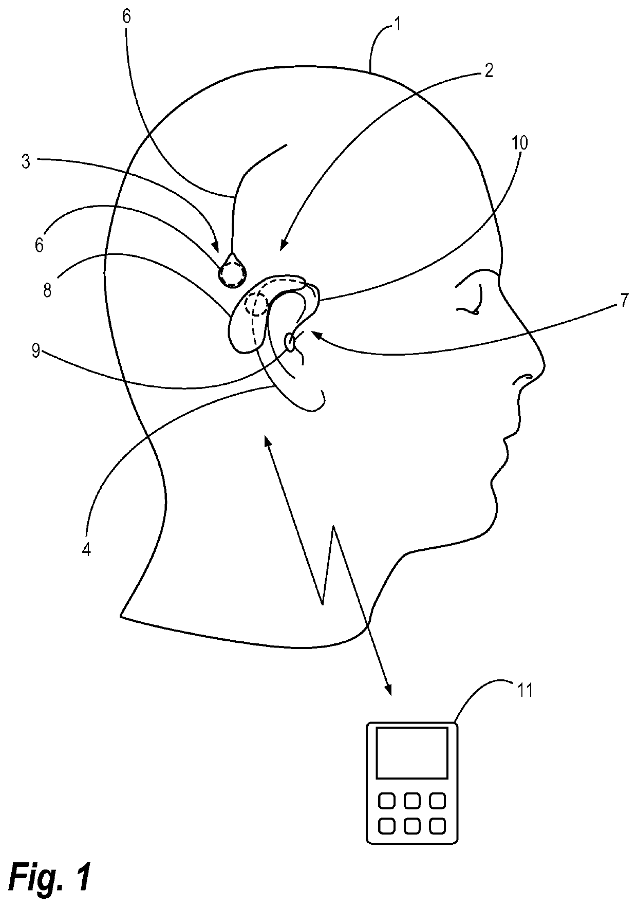 EEG monitoring apparatus and method for presenting messages therein