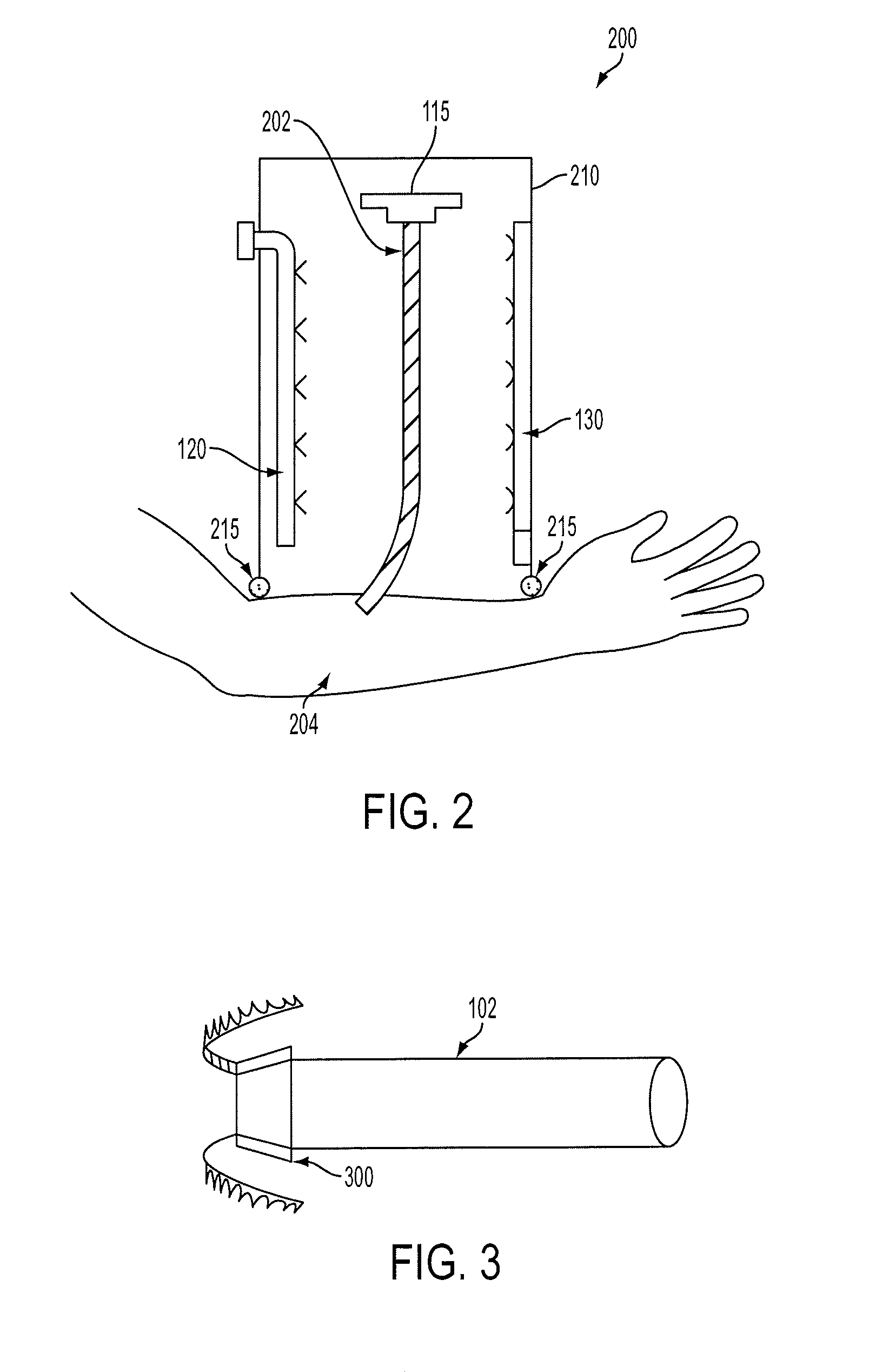 Vessel Treatment Systems, Methods, and Kits