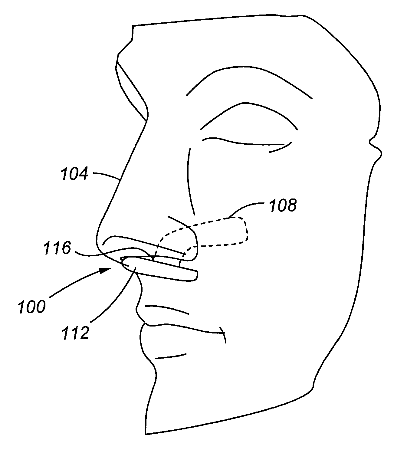 Nose pack method and apparatus