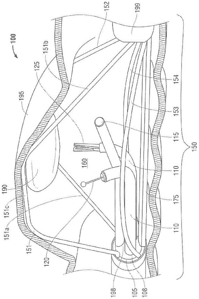 Multi-lumen-catheter retractor system for a minimally-invasive, operative gastrointestinal treatment