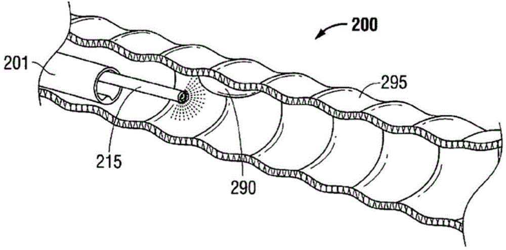 Multi-lumen-catheter retractor system for a minimally-invasive, operative gastrointestinal treatment