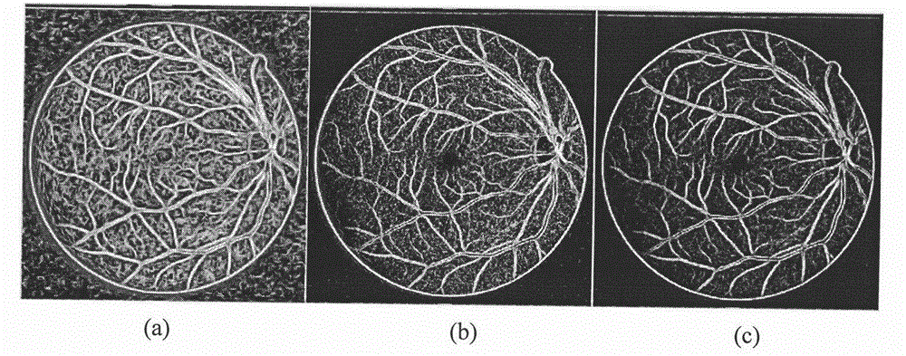 Fundus image vascular segmentation method based on phase congruency